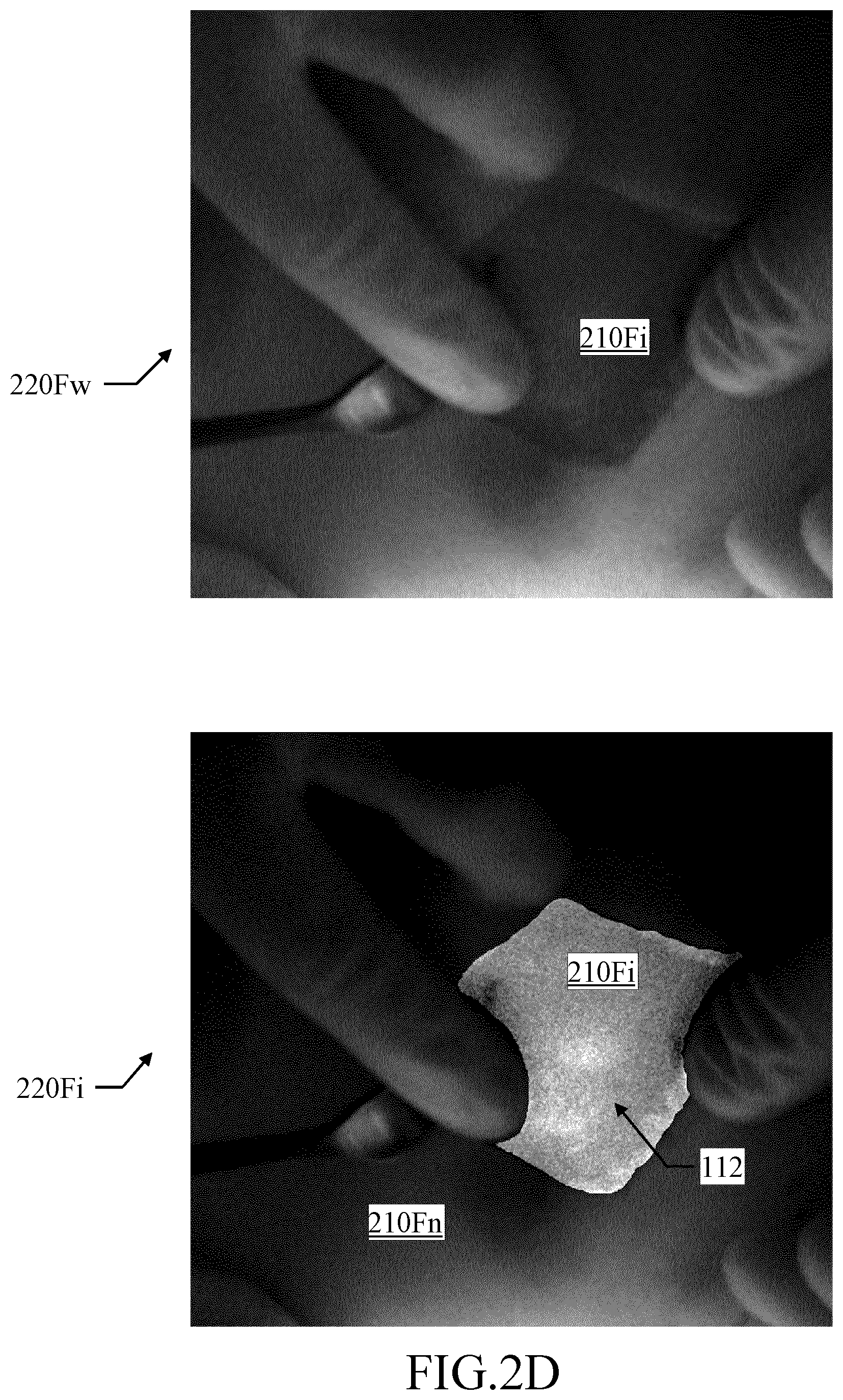 Patent US12324648 Figure 5 – Assisting medical procedures with luminescence images processed in limited informative regions identified in corresponding auxiliary images