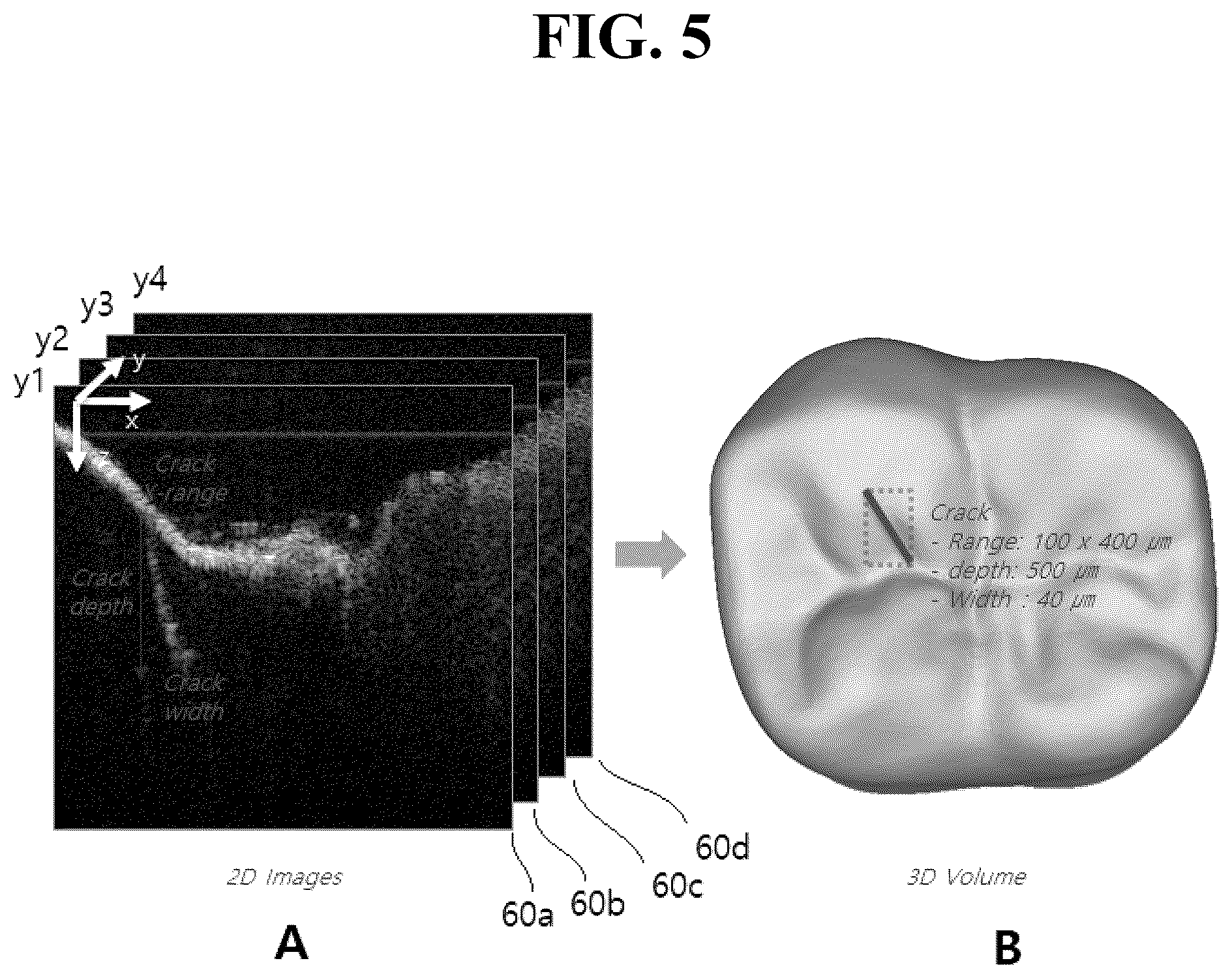 Patent US12324650 Figure 5 – Intraoral scanner having tomographic imaging function and method for detecting cracks in oral structures using the same