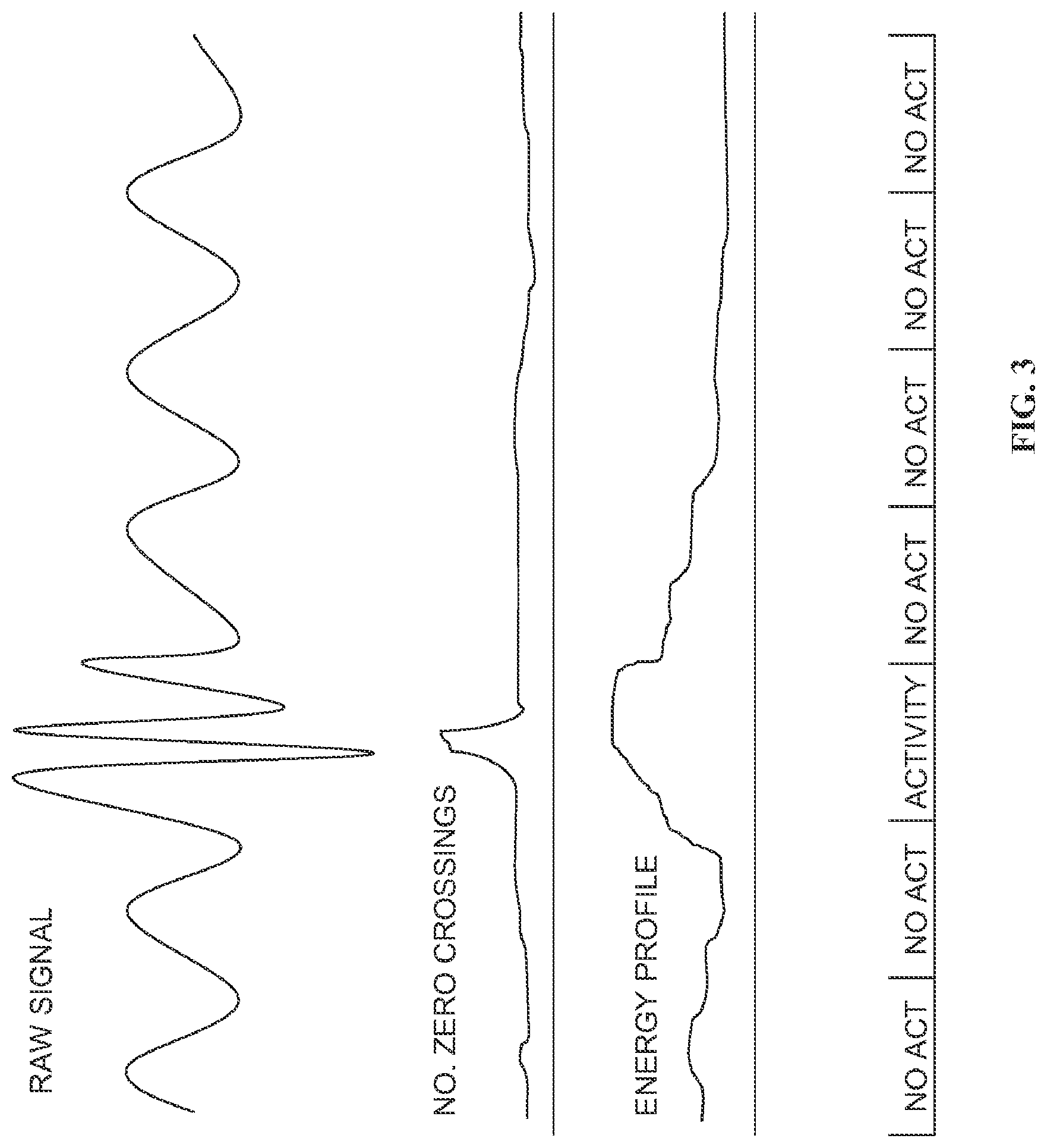 Patent US12324652 Figure 3 – Apparatus, system, and method for monitoring physiological signs