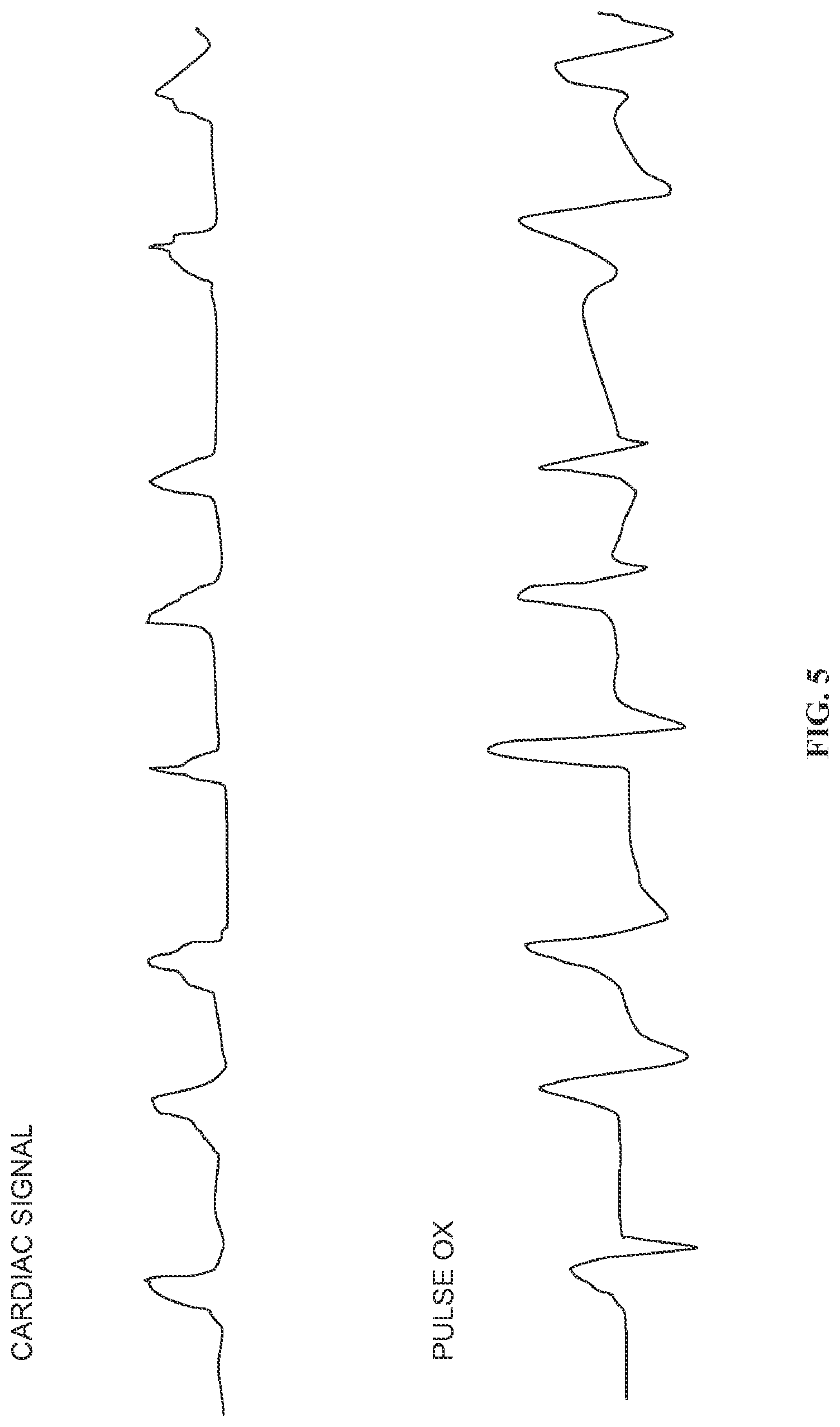 Patent US12324652 Figure 5 – Apparatus, system, and method for monitoring physiological signs