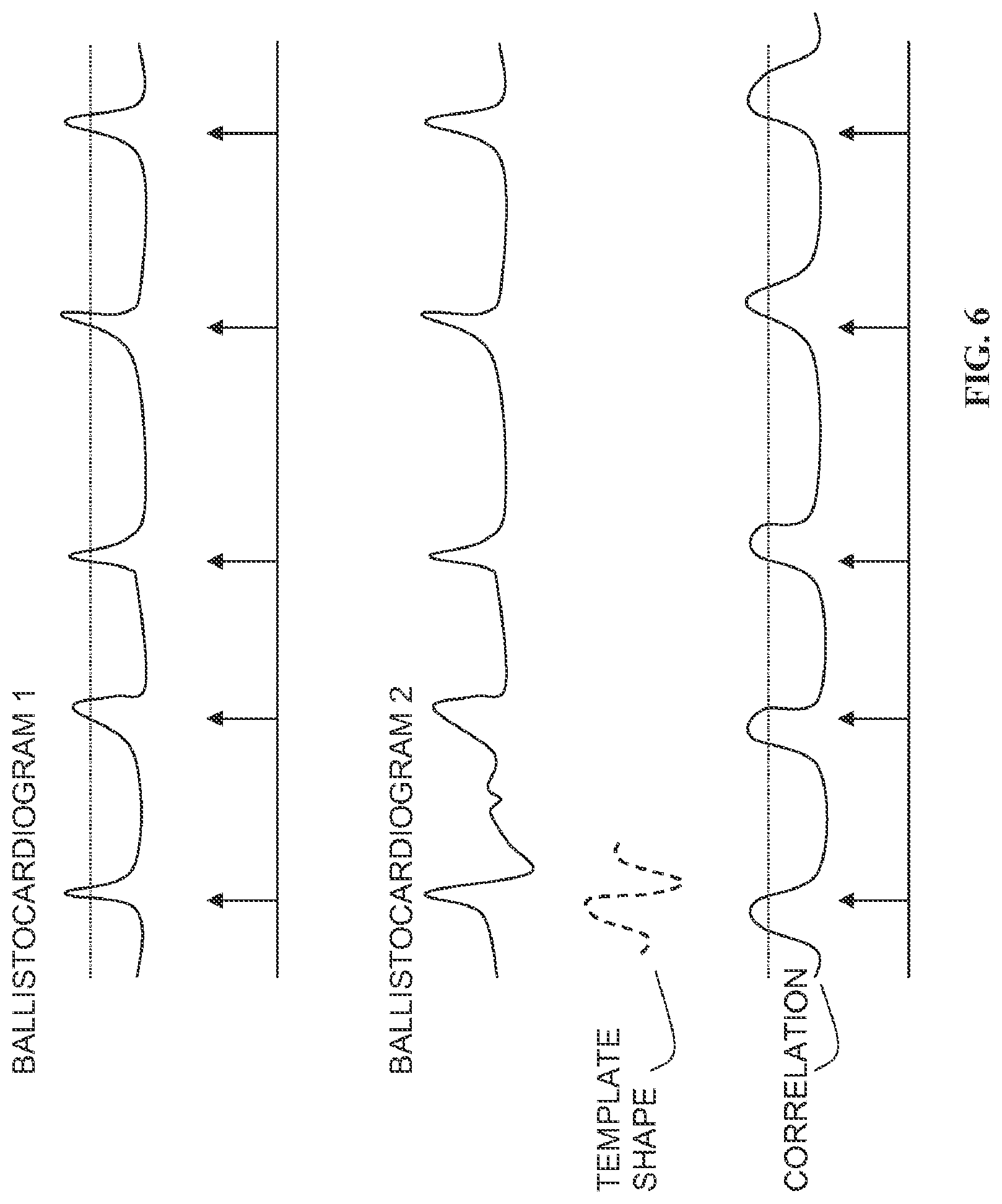 Patent US12324652 Figure 6 – Apparatus, system, and method for monitoring physiological signs