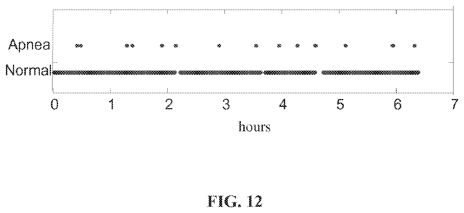 Patent US12324652 Figure 12 – Apparatus, system, and method for monitoring physiological signs