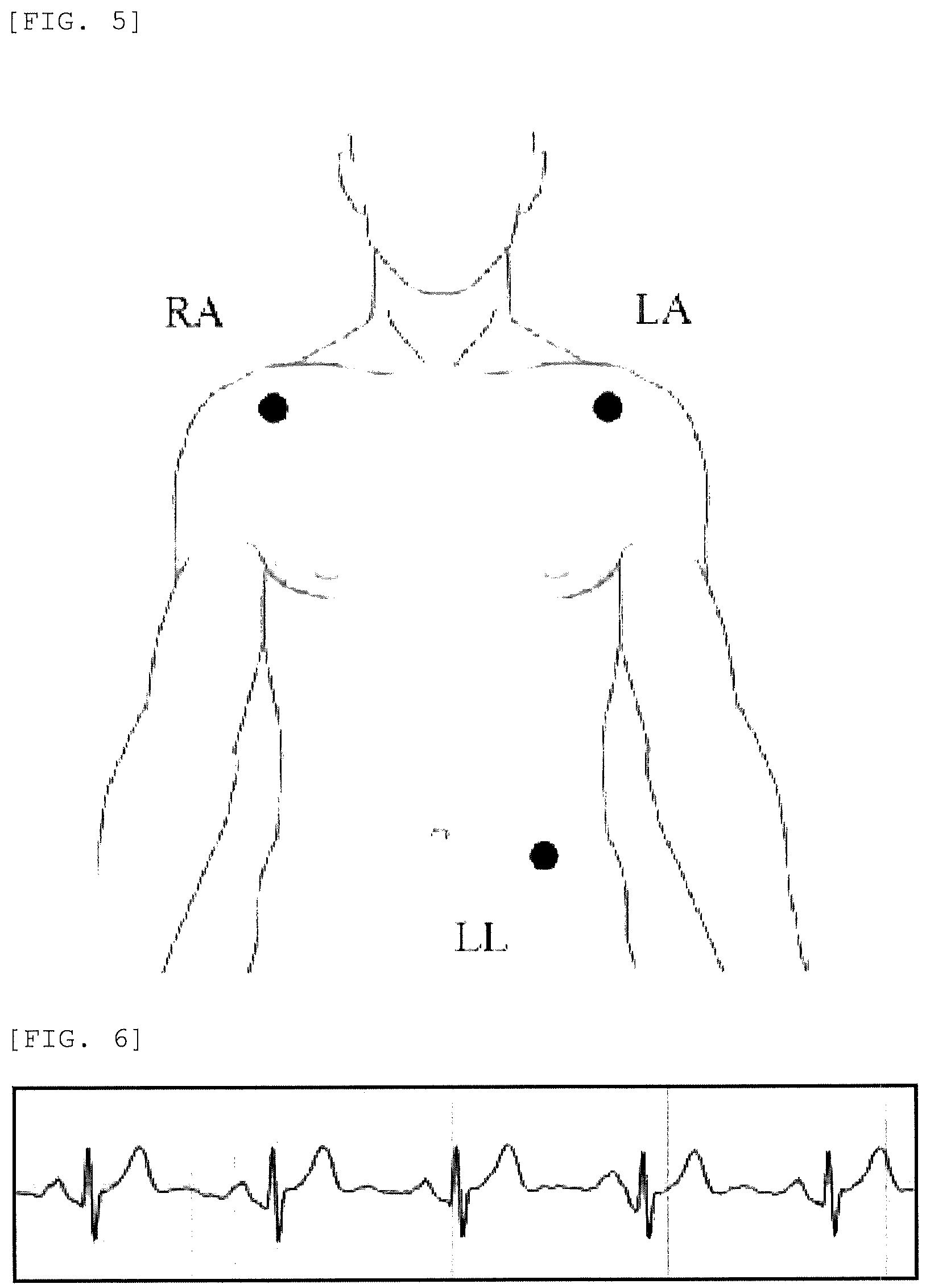 Patent US12324667 Figure 4 – Bio-electrode composition, bio-electrode, method for manufacturing bio-electrode, polymer compound, and composite