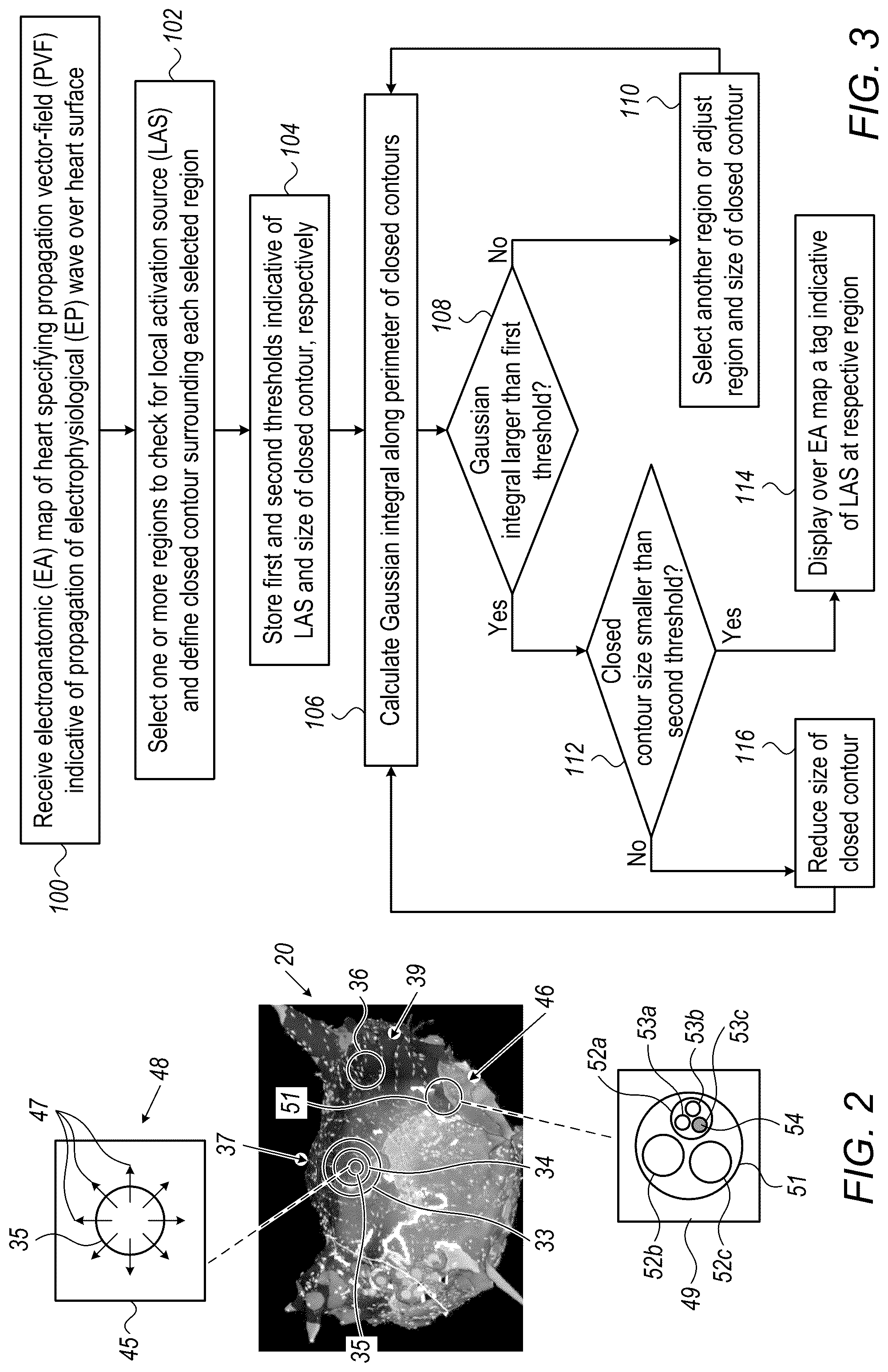 Patent US12324669 Figure 2 – Detecting local activation source in atrial fibrillation