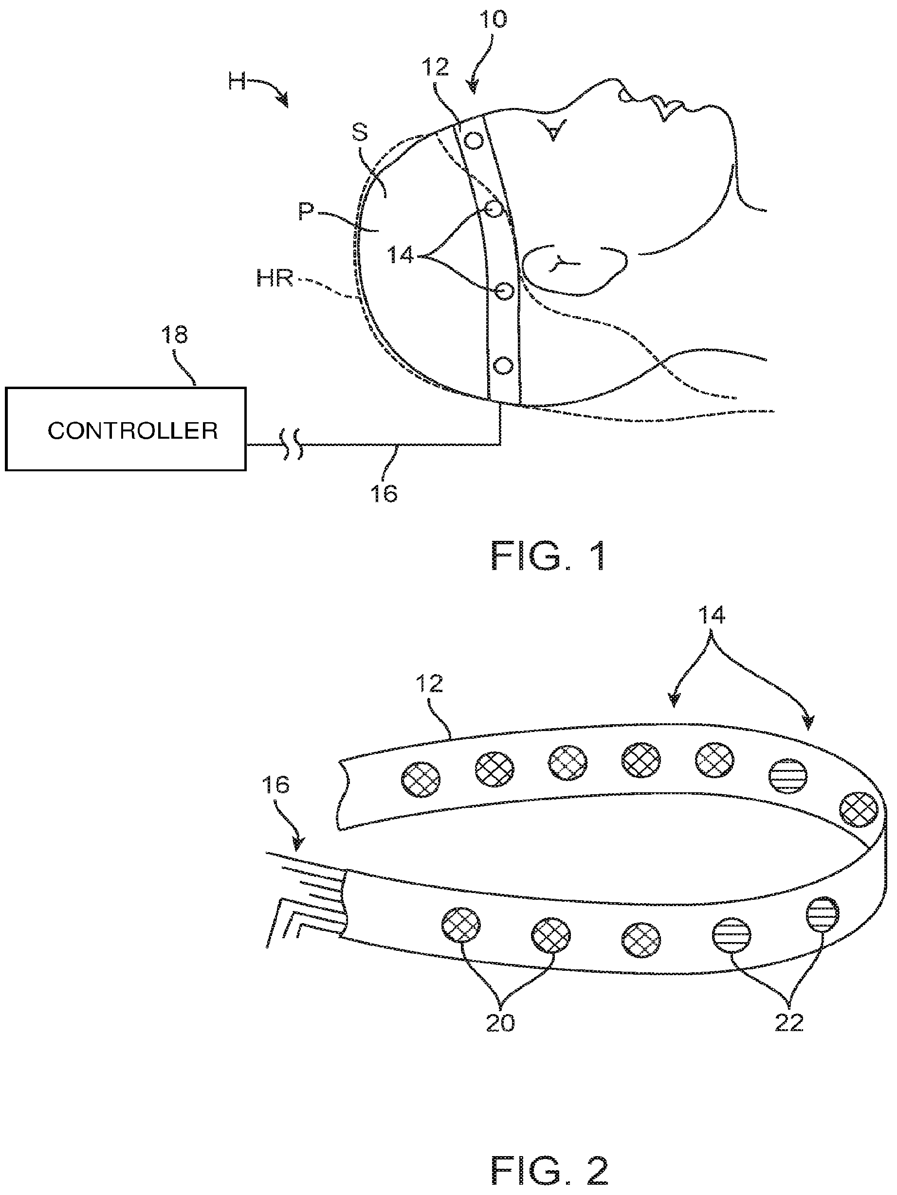 Patent US12324670 Figure 1 – Methods and apparatus for electrode placement and tracking