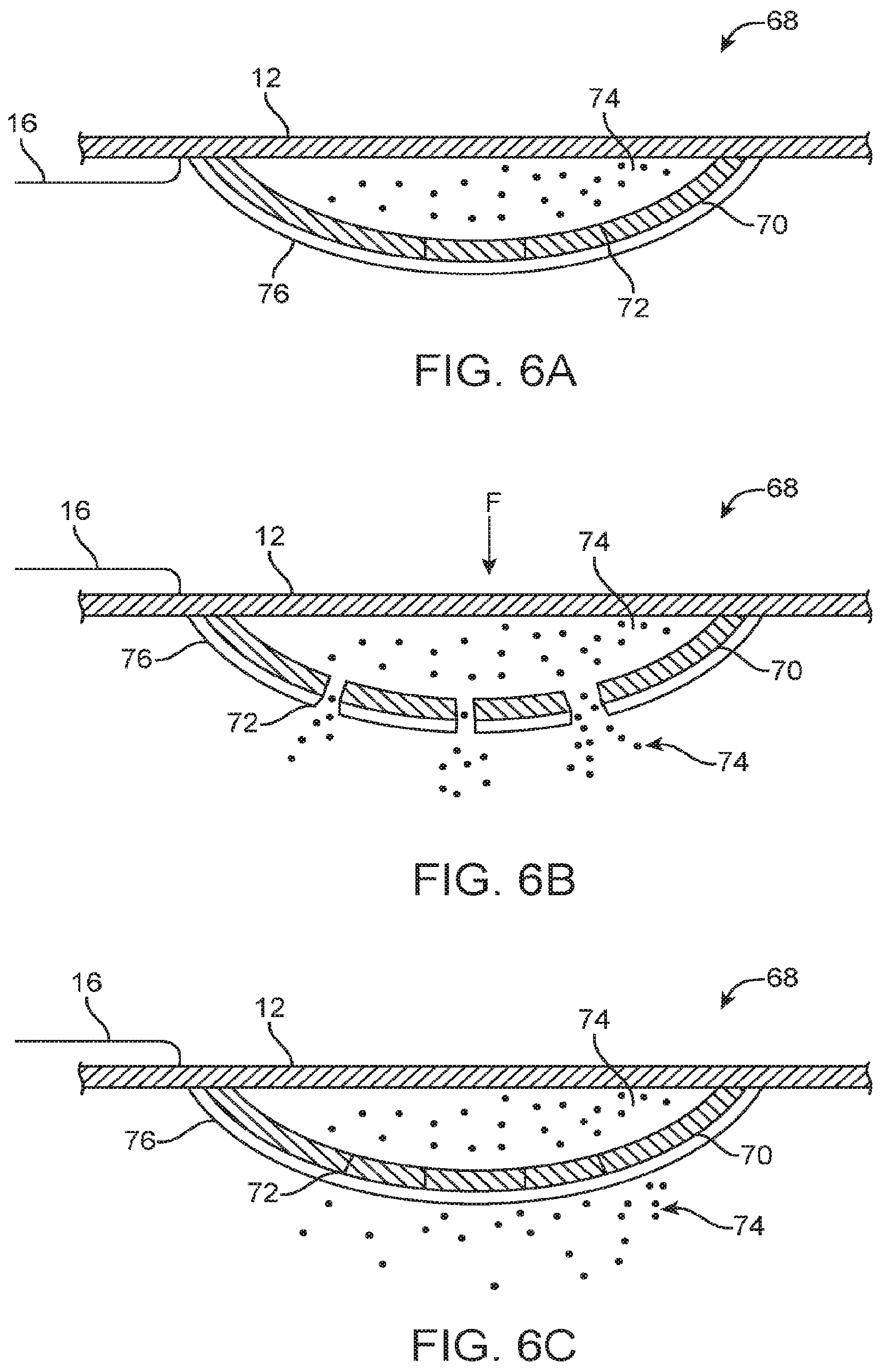 Patent US12324670 Figure 3 – Methods and apparatus for electrode placement and tracking