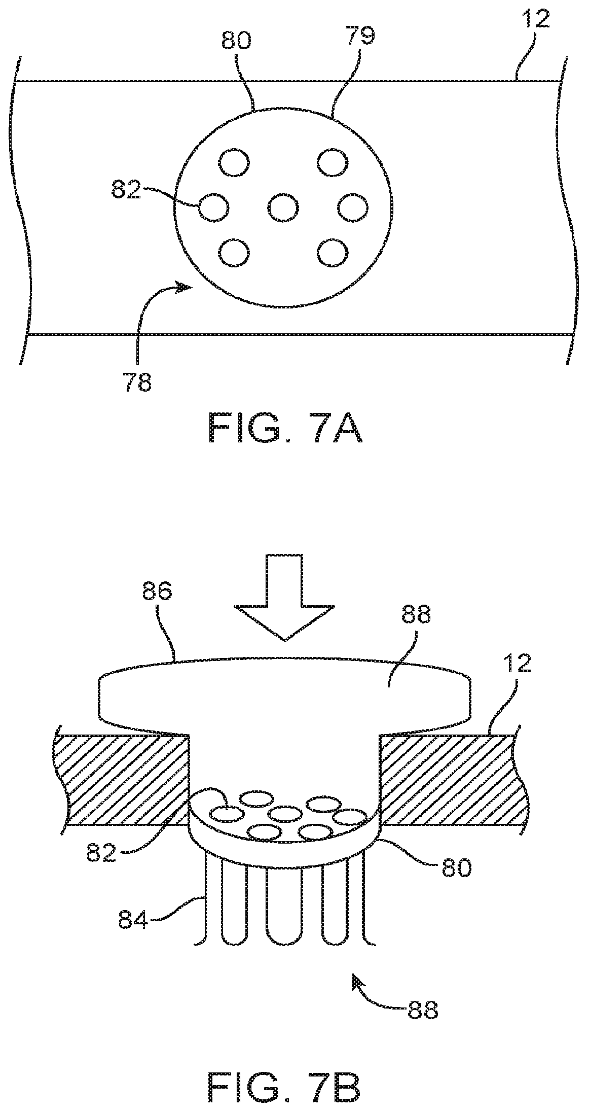 Patent US12324670 Figure 4 – Methods and apparatus for electrode placement and tracking