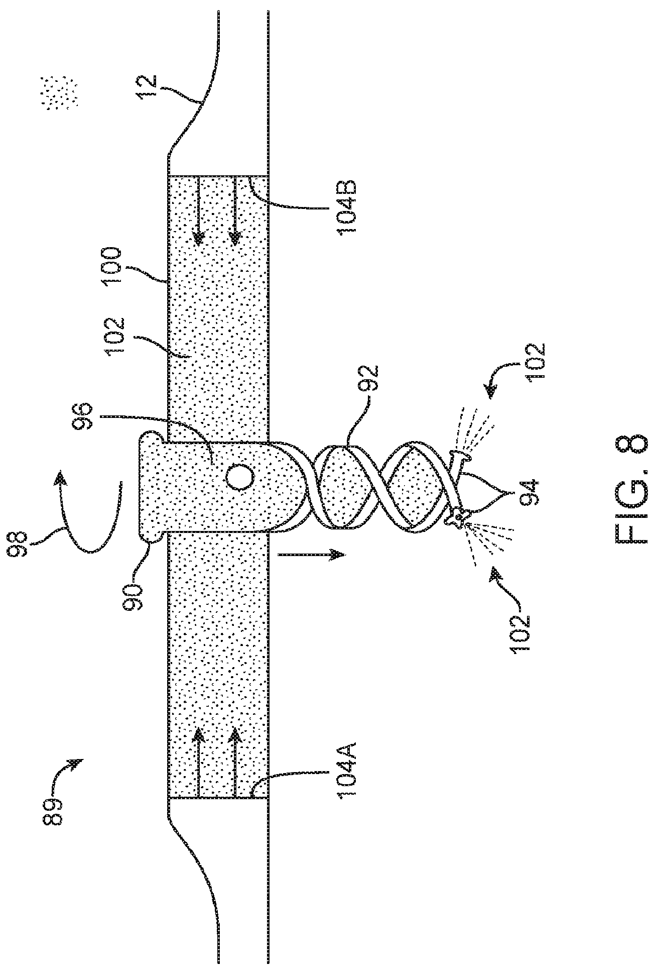 Patent US12324670 Figure 5 – Methods and apparatus for electrode placement and tracking