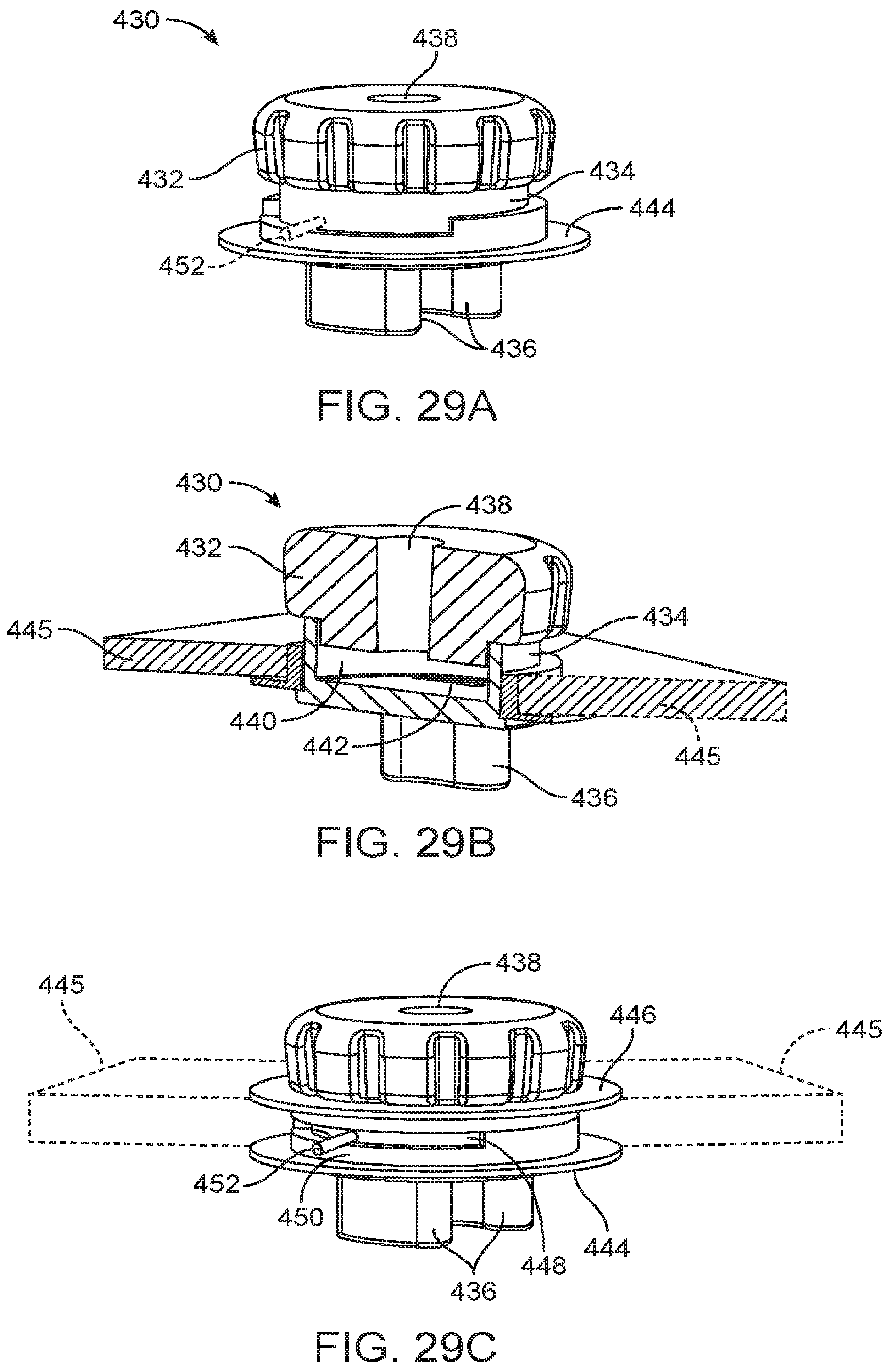 Patent US12324670 Figure 15 – Methods and apparatus for electrode placement and tracking