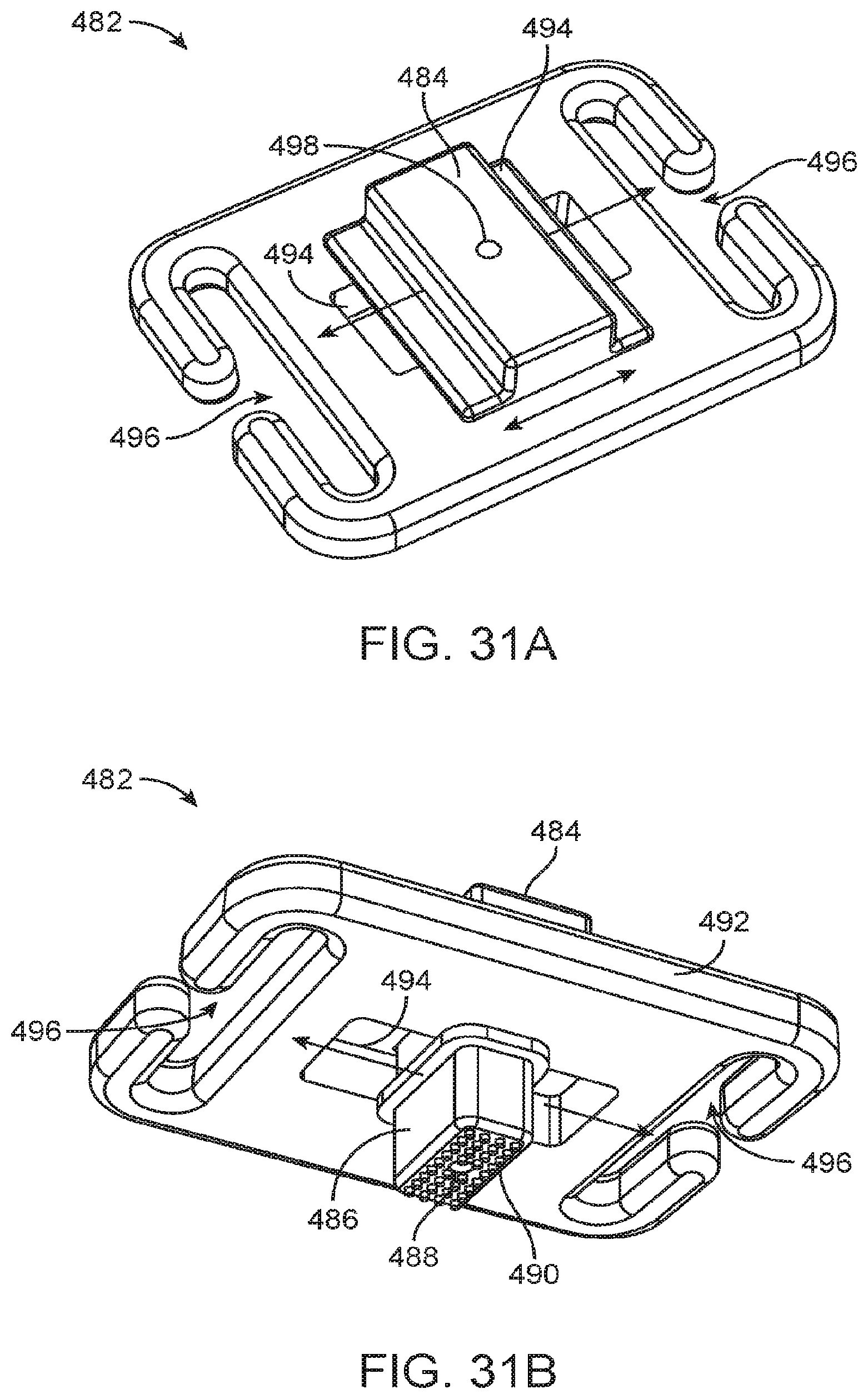 Patent US12324670 Figure 17 – Methods and apparatus for electrode placement and tracking