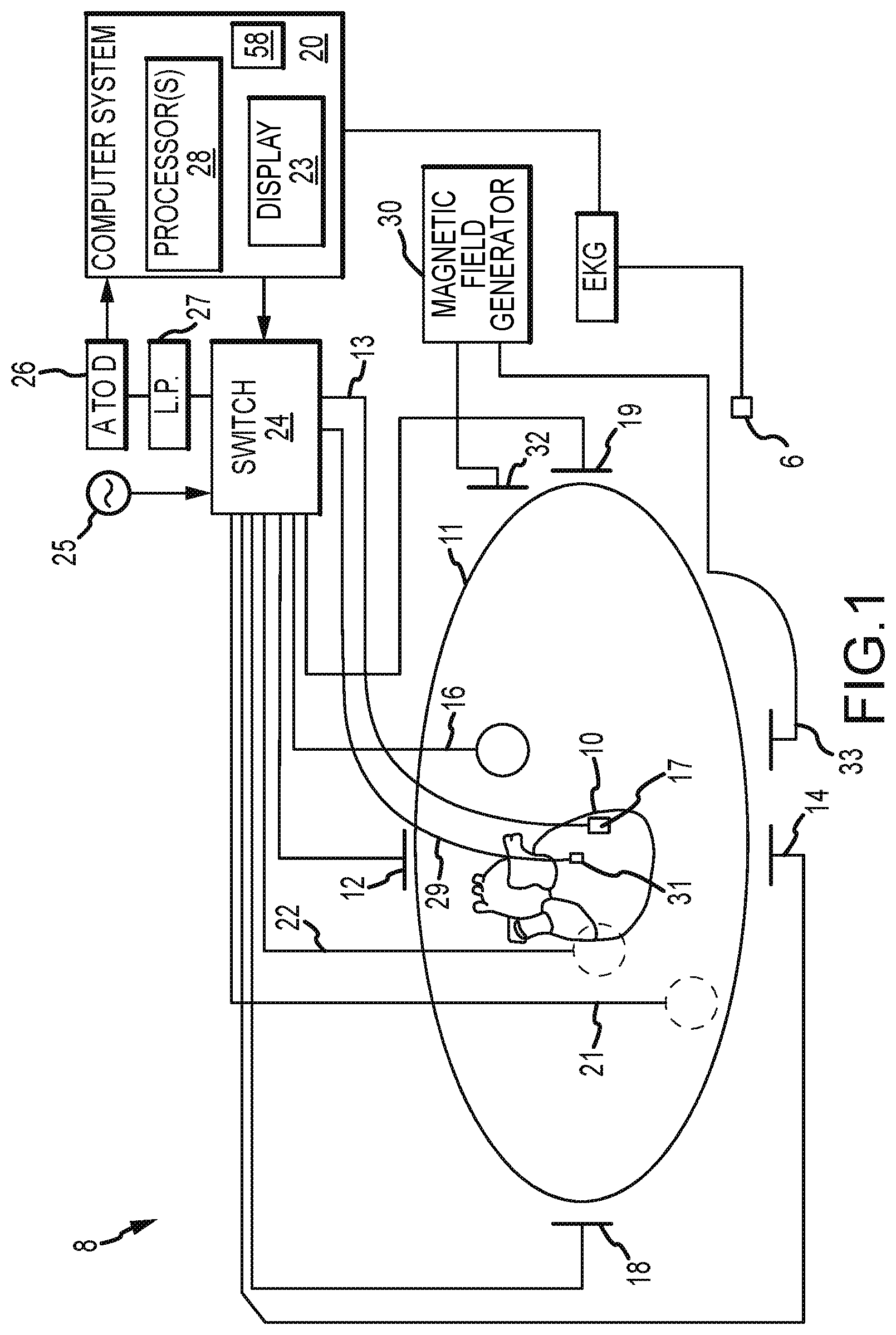 Patent US12324671 Figure 1 – System, method, and apparatus for mapping local activation times
