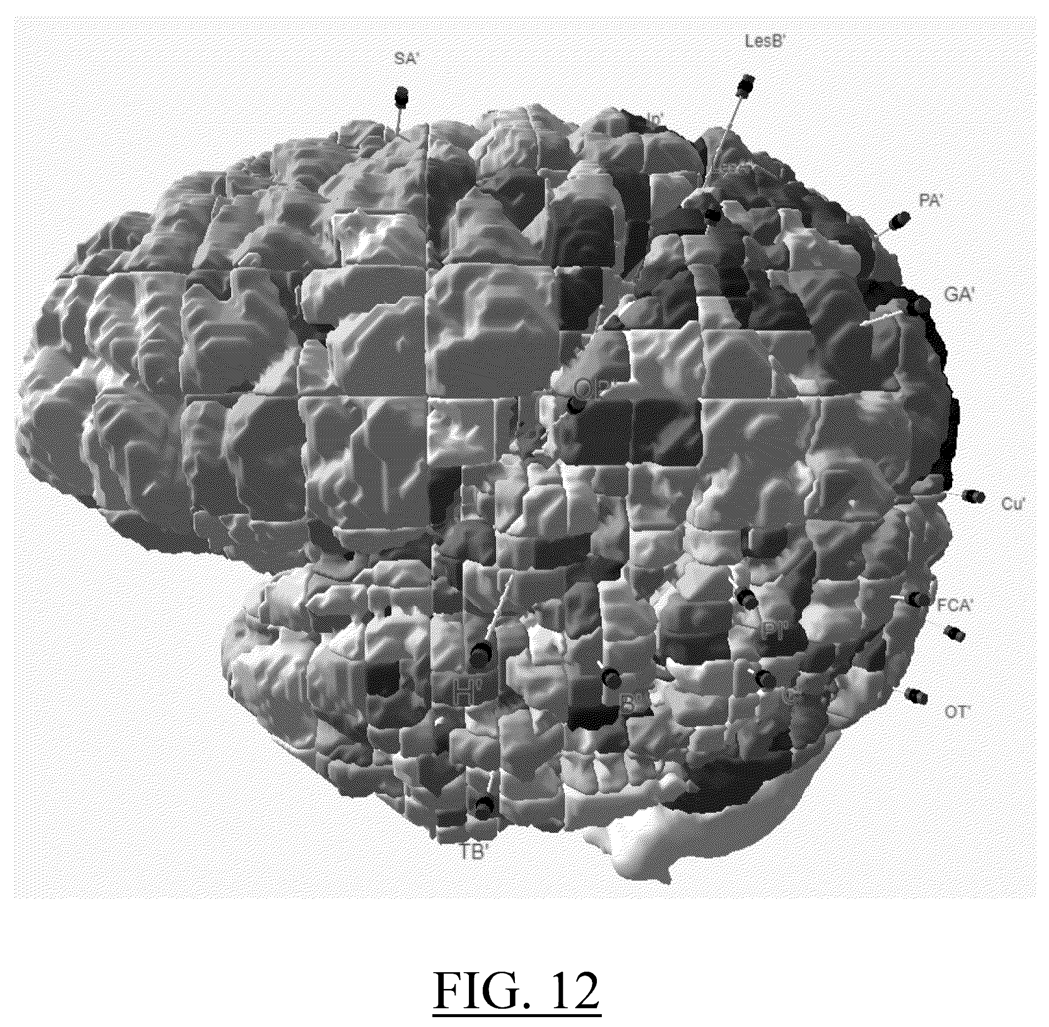 Patent US12324674 Figure 8 – Voxelization of a 3D structural medical image of a human's brain
