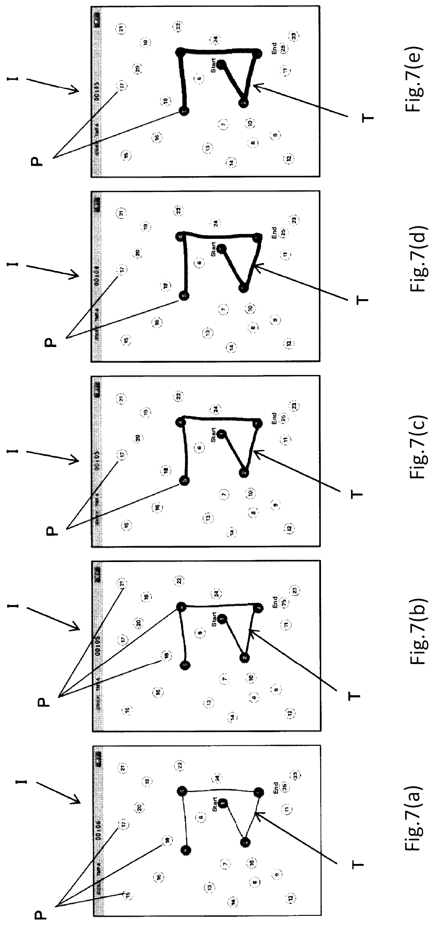 Patent US12324676 Figure 7 – System, computer program and method for displaying TMT test result