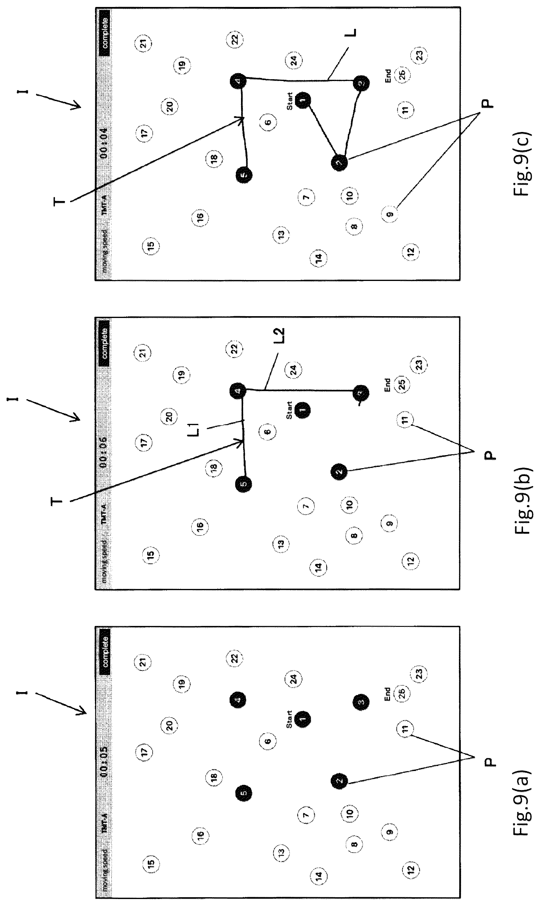 Patent US12324676 Figure 9 – System, computer program and method for displaying TMT test result