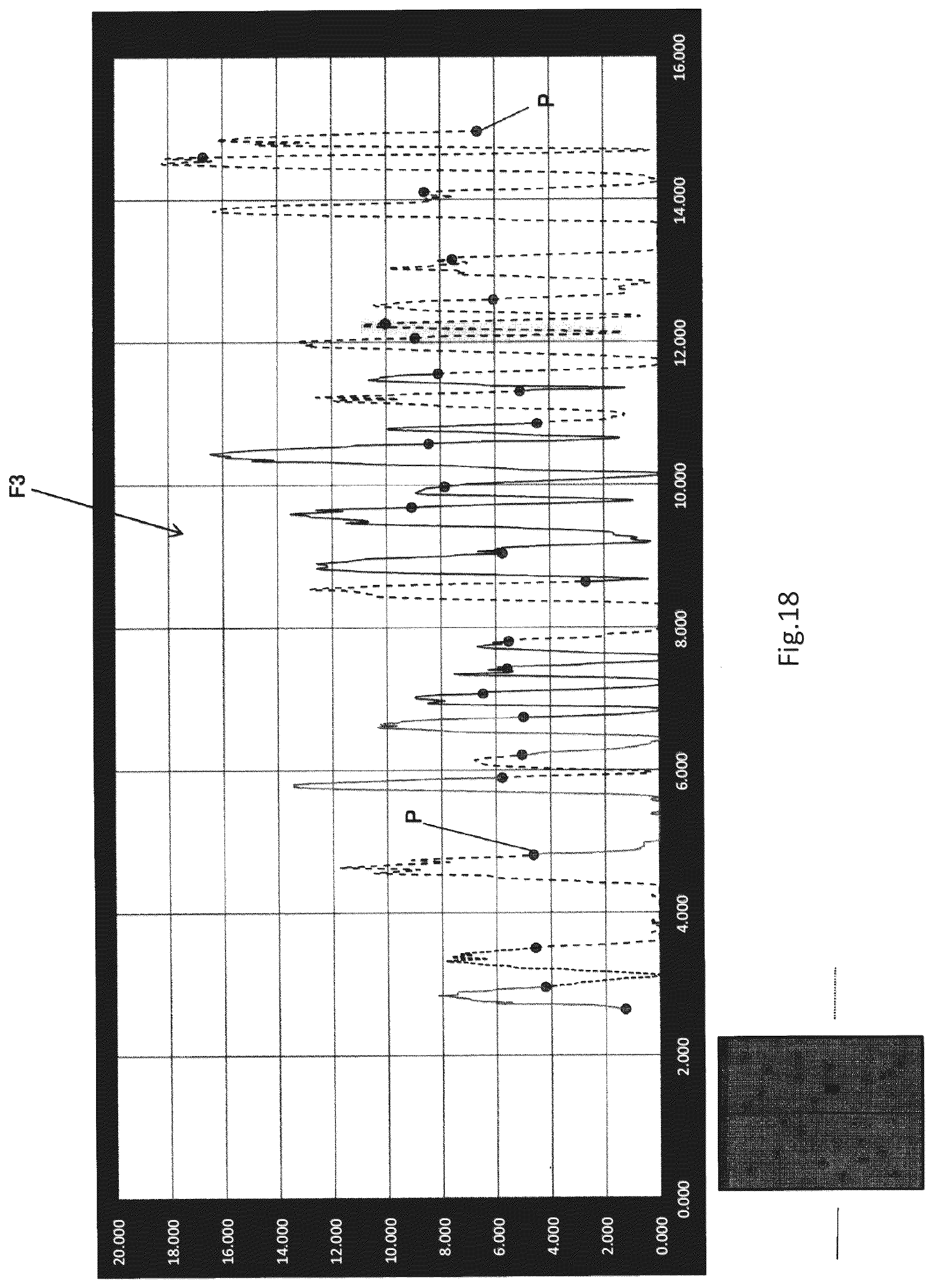 Patent US12324676 Figure 18 – System, computer program and method for displaying TMT test result