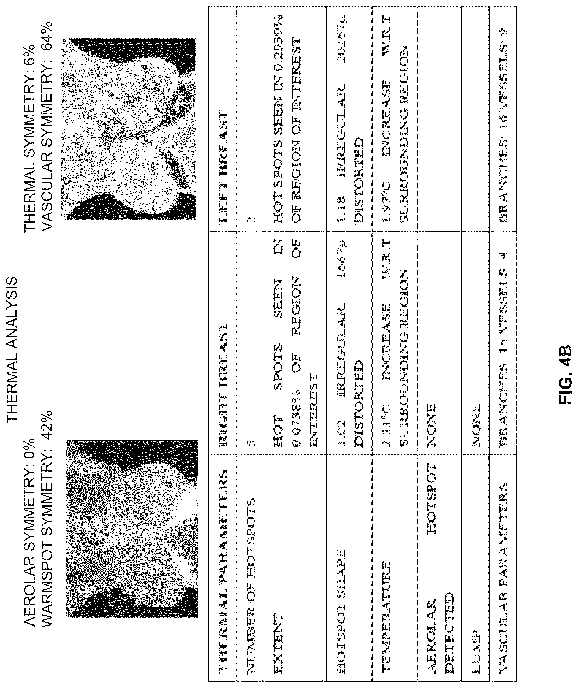 Patent US12324677 Figure 5 – System and method for quantitative evaluation of breast health