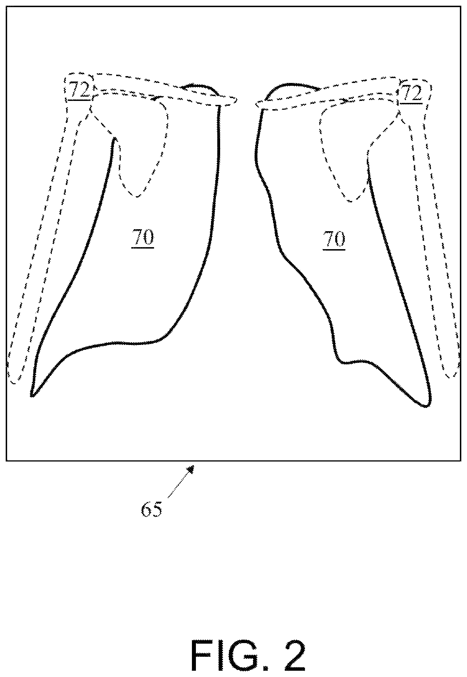Patent US12324690 Figure 2 – Method of obtaining x-ray images
