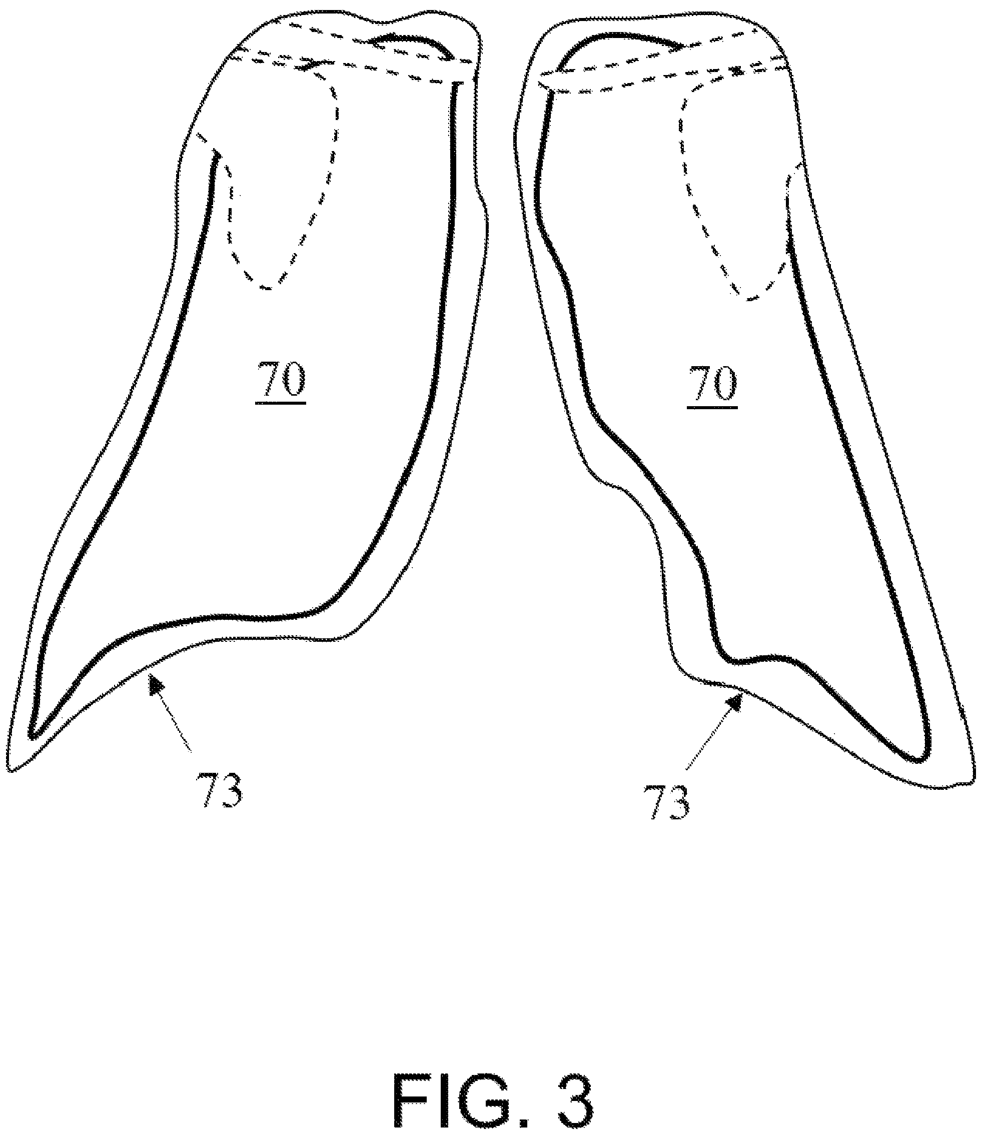 Patent US12324690 Figure 3 – Method of obtaining x-ray images