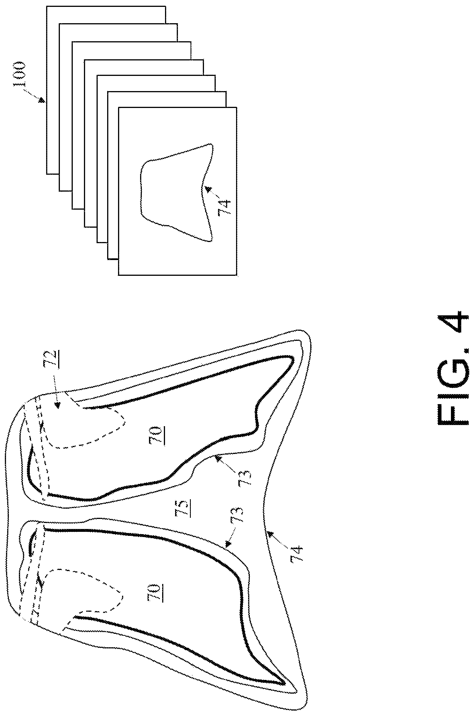 Patent US12324690 Figure 4 – Method of obtaining x-ray images