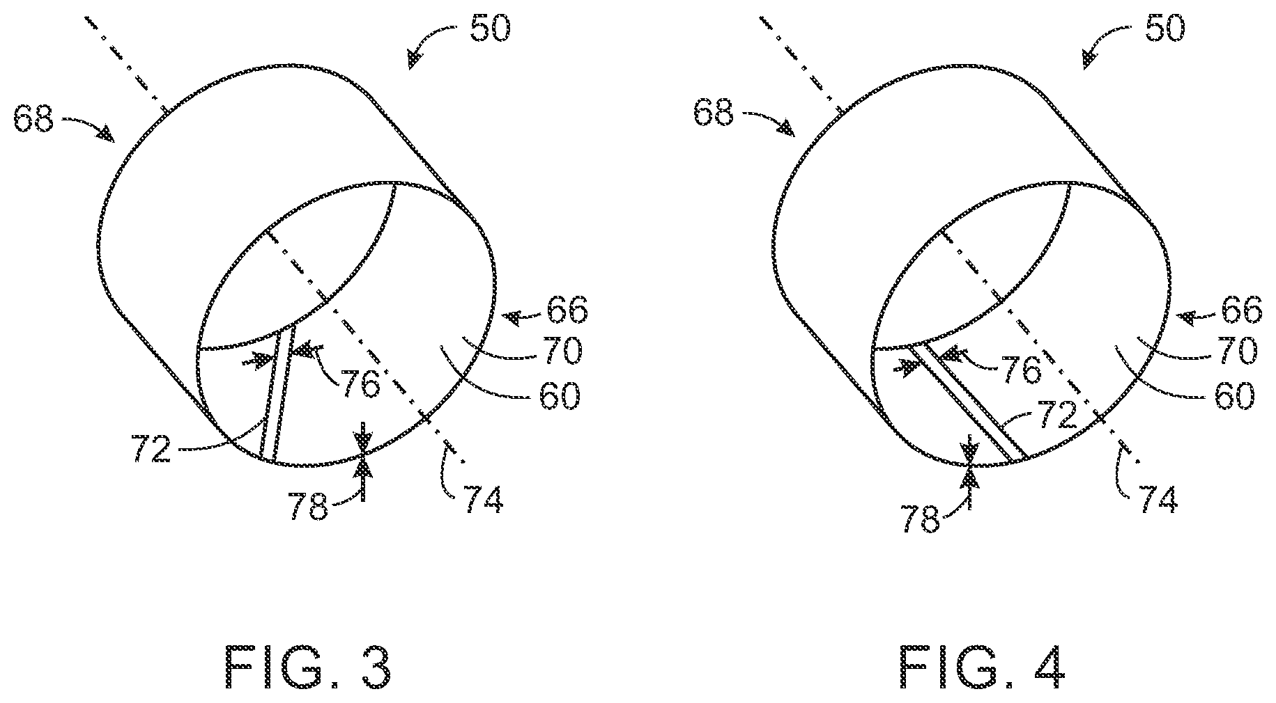 Patent US12324692 Figure 3 – Joint for a scan window formed to a cylinder