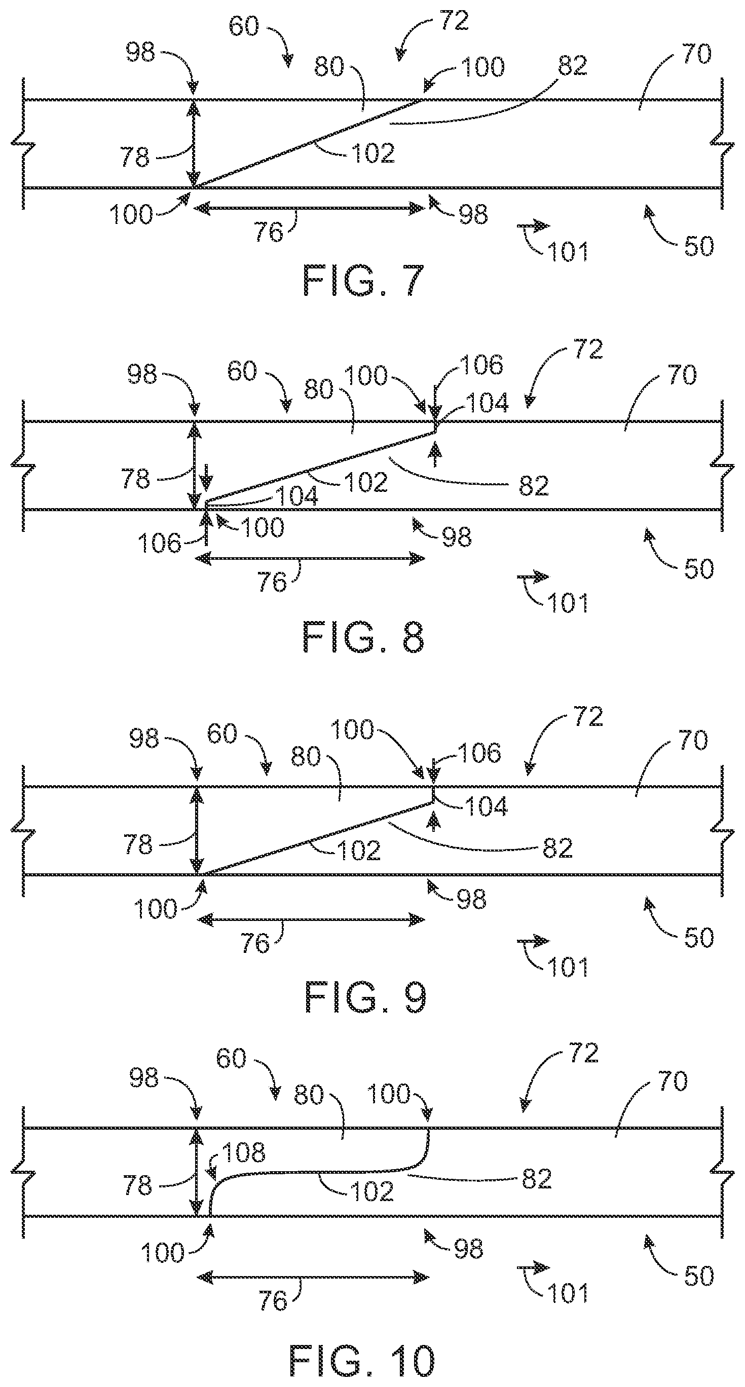 Patent US12324692 Figure 5 – Joint for a scan window formed to a cylinder