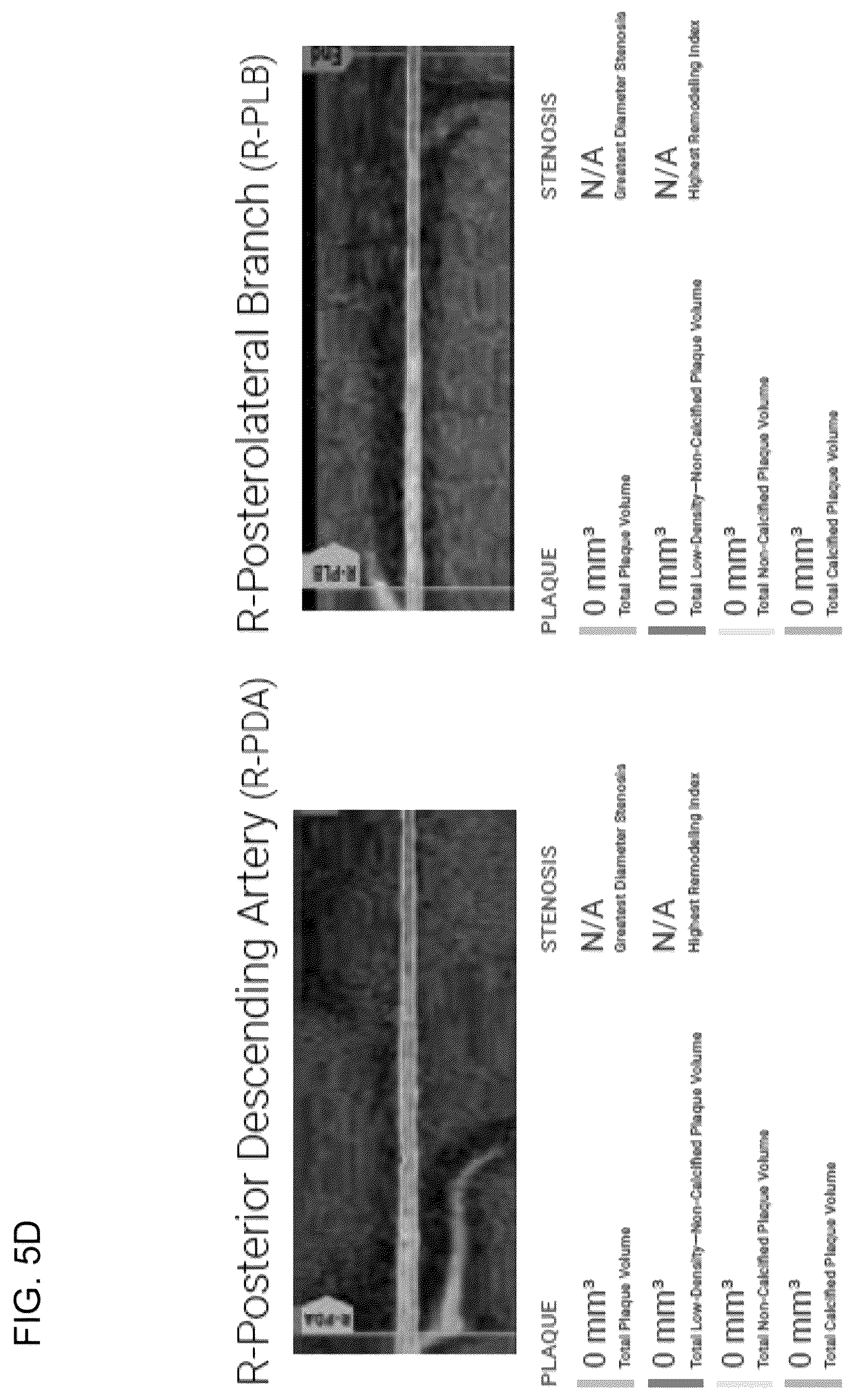 Patent US12324695 Figure 14 – Systems, methods, and devices for medical image analysis, diagnosis, risk stratification, decision making and/or disease tracking