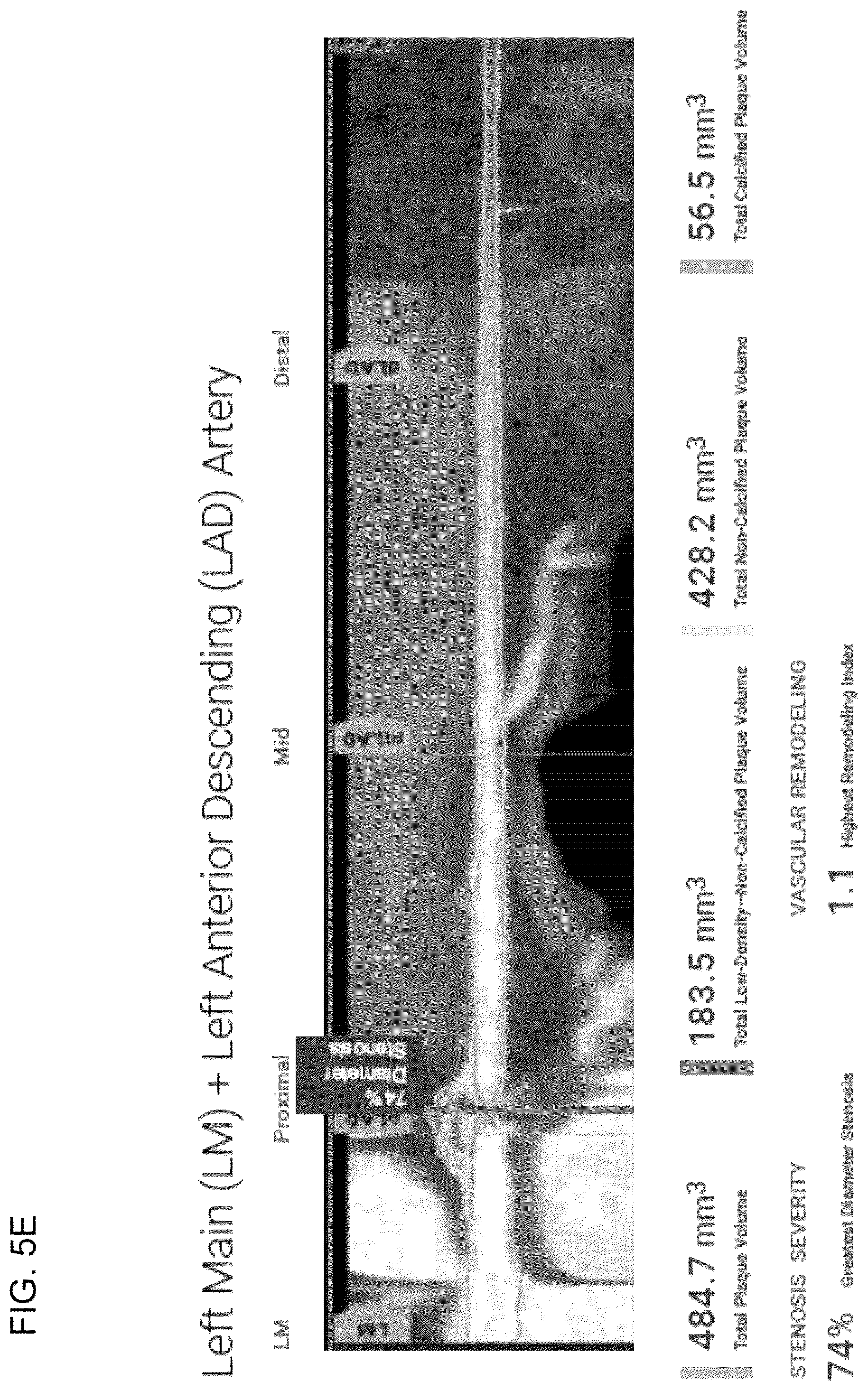 Patent US12324695 Figure 15 – Systems, methods, and devices for medical image analysis, diagnosis, risk stratification, decision making and/or disease tracking