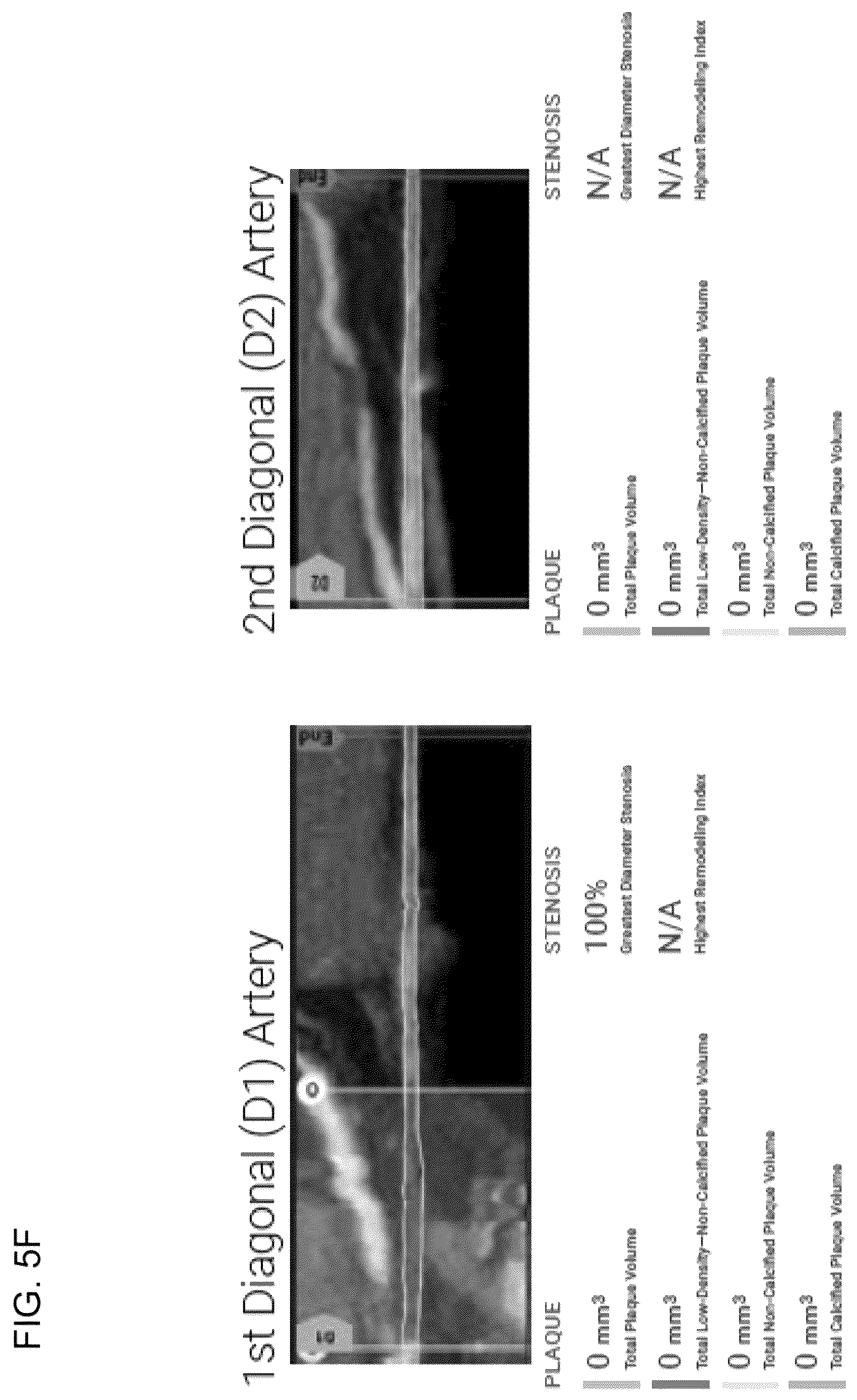 Patent US12324695 Figure 16 – Systems, methods, and devices for medical image analysis, diagnosis, risk stratification, decision making and/or disease tracking