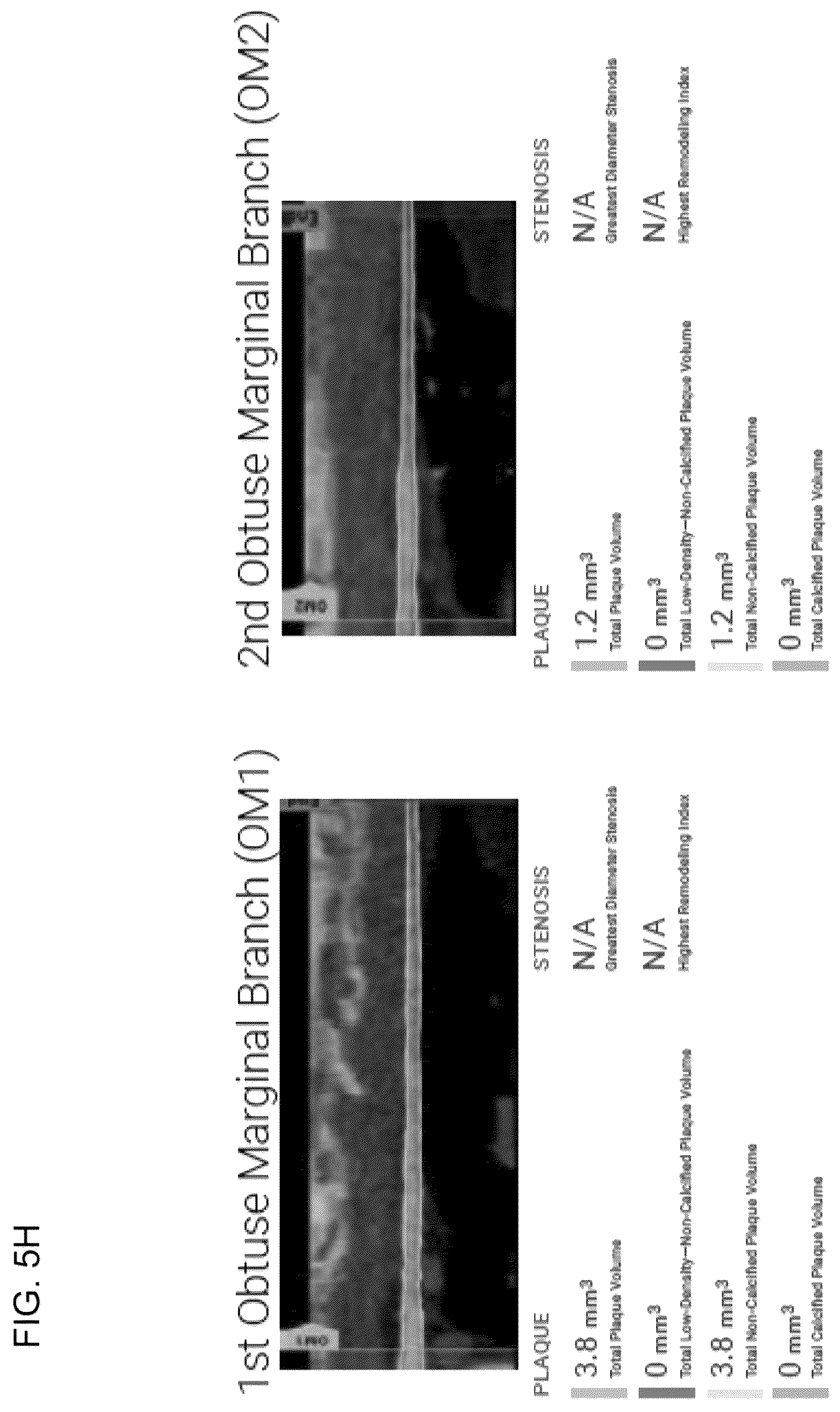 Patent US12324695 Figure 18 – Systems, methods, and devices for medical image analysis, diagnosis, risk stratification, decision making and/or disease tracking