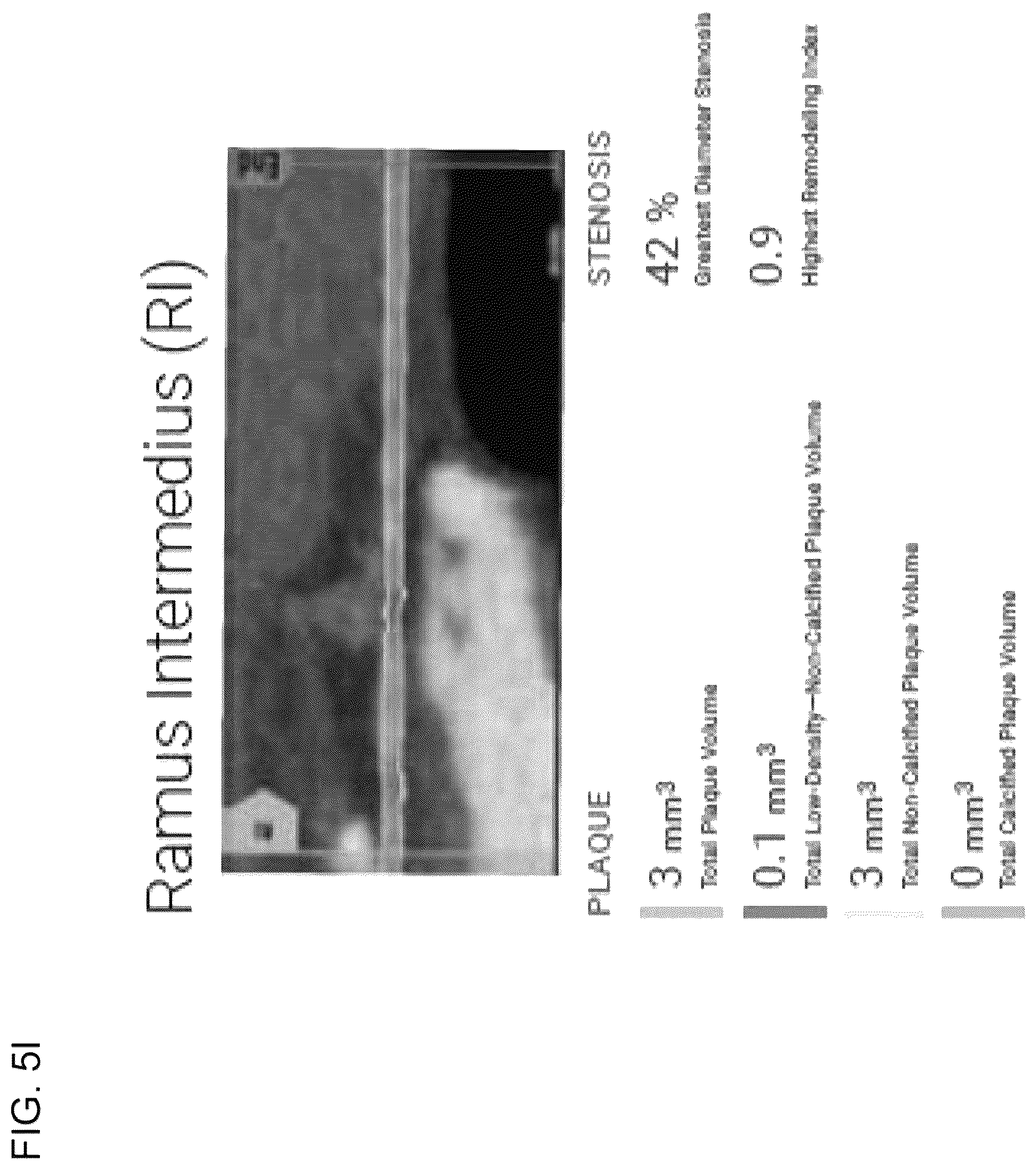 Patent US12324695 Figure 19 – Systems, methods, and devices for medical image analysis, diagnosis, risk stratification, decision making and/or disease tracking
