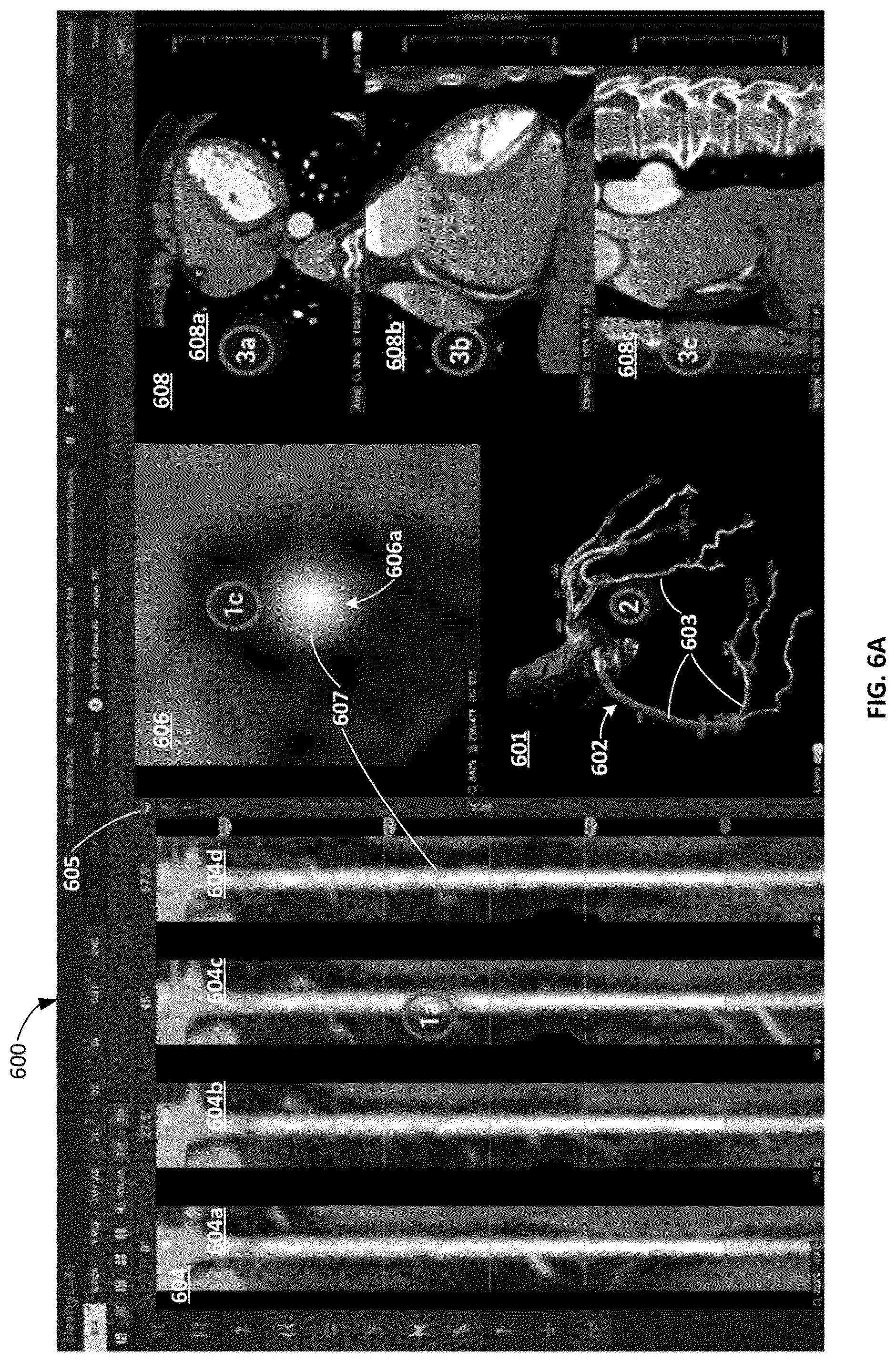 Patent US12324695 Figure 20 – Systems, methods, and devices for medical image analysis, diagnosis, risk stratification, decision making and/or disease tracking