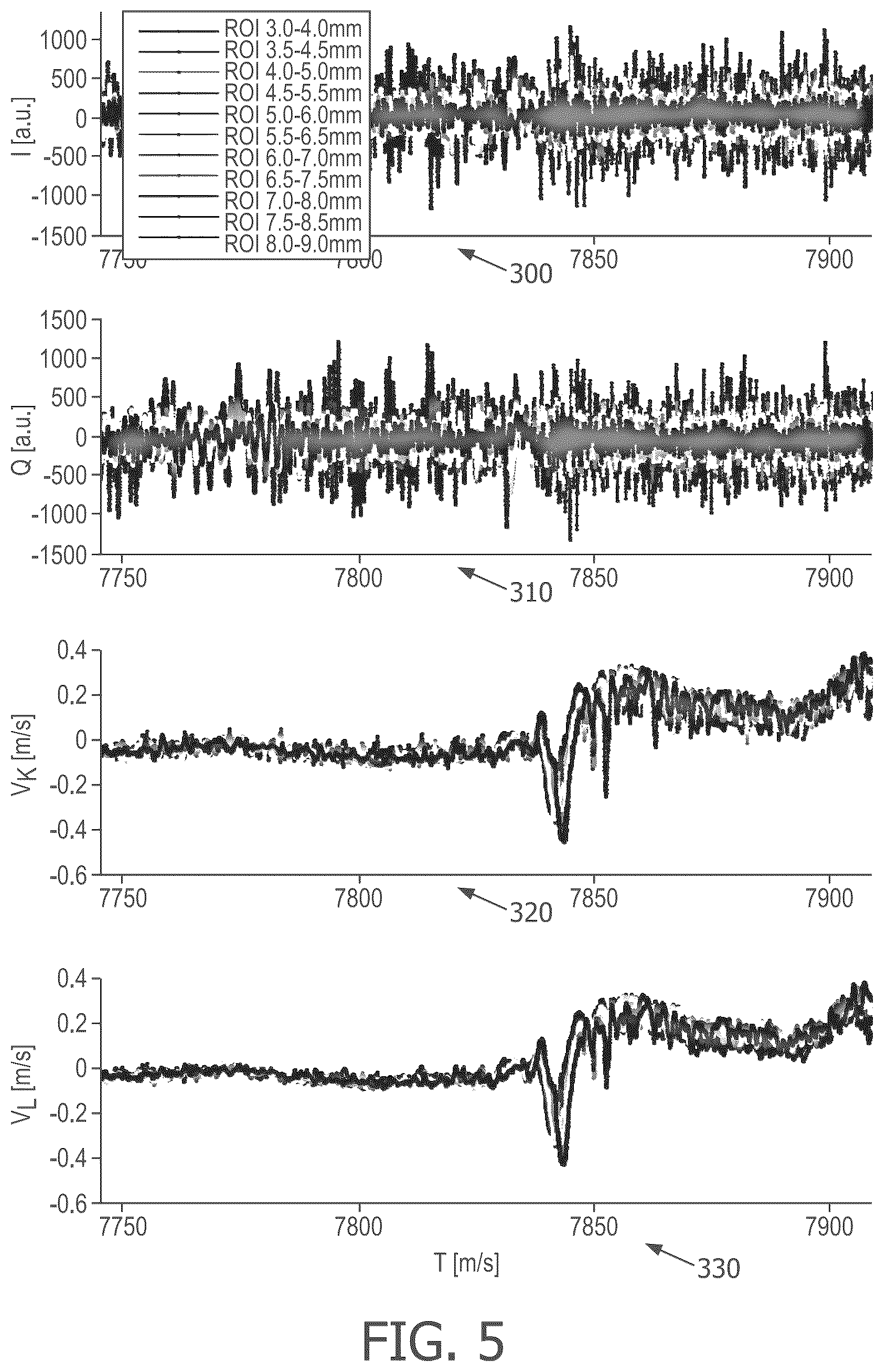 Patent US12324700 Figure 4 – Systems and method for performing pulse wave velocity measurements