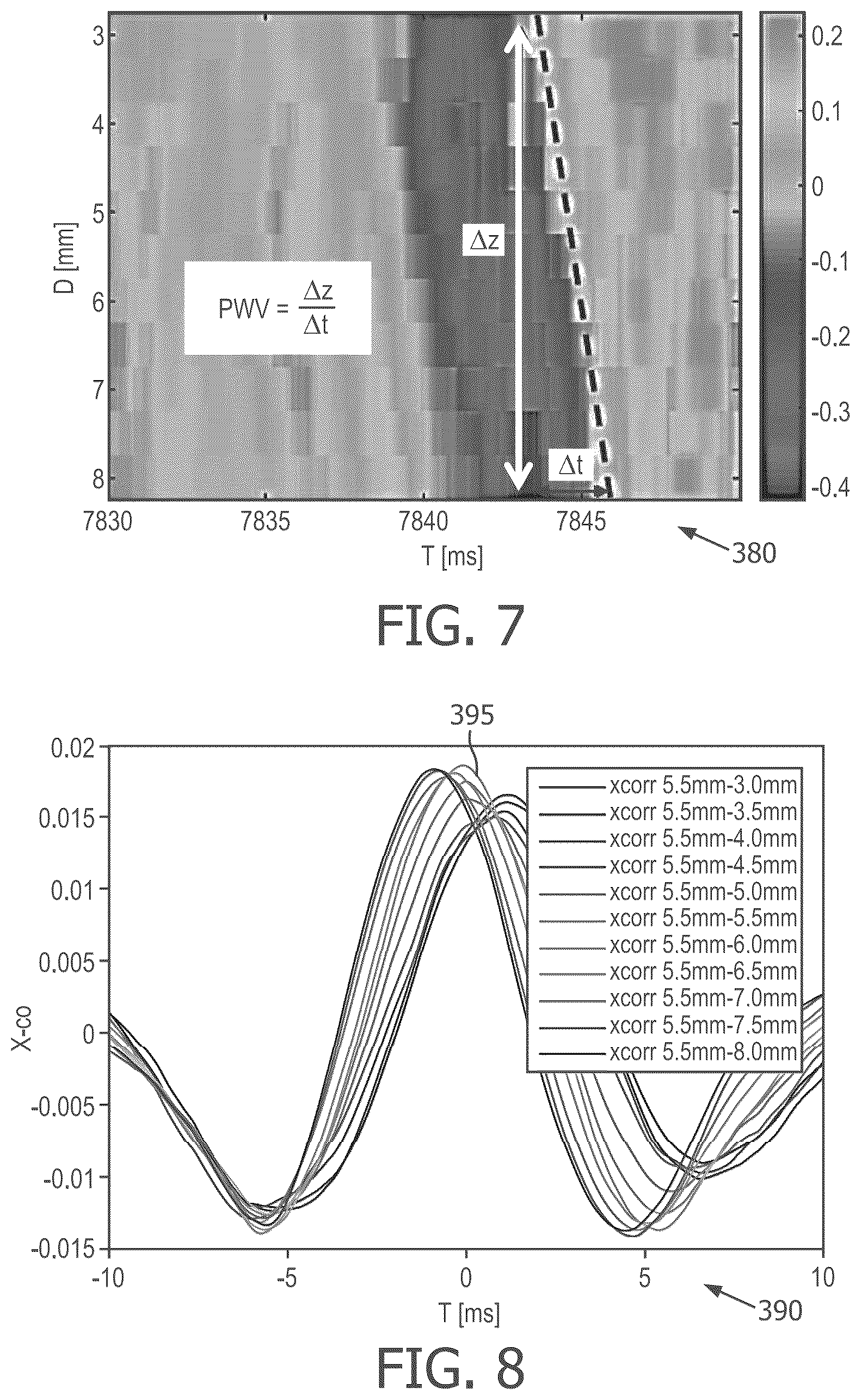 Patent US12324700 Figure 6 – Systems and method for performing pulse wave velocity measurements