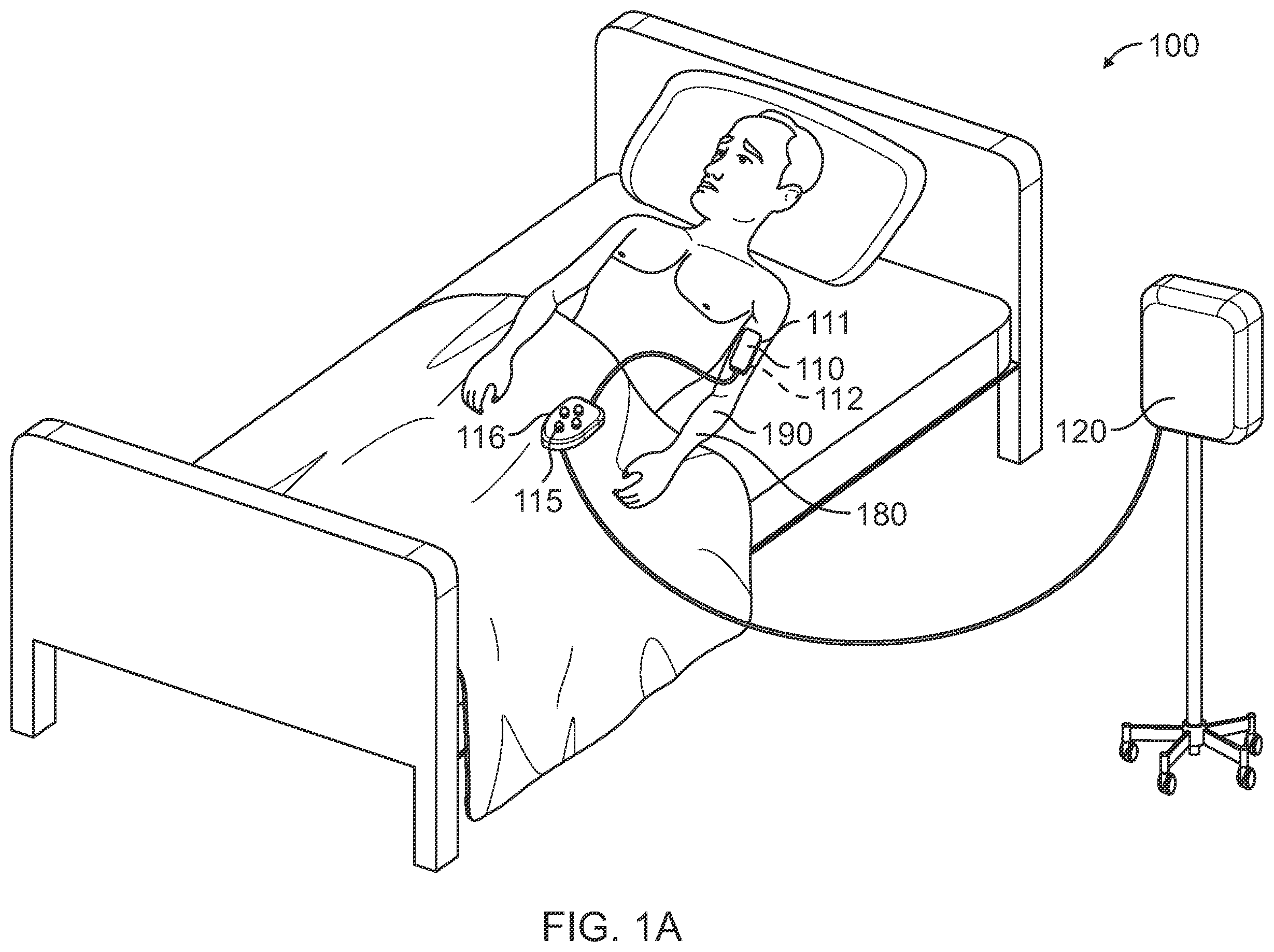 Patent US12324704 Figure 1 – Securement of hands-free ultrasound probe