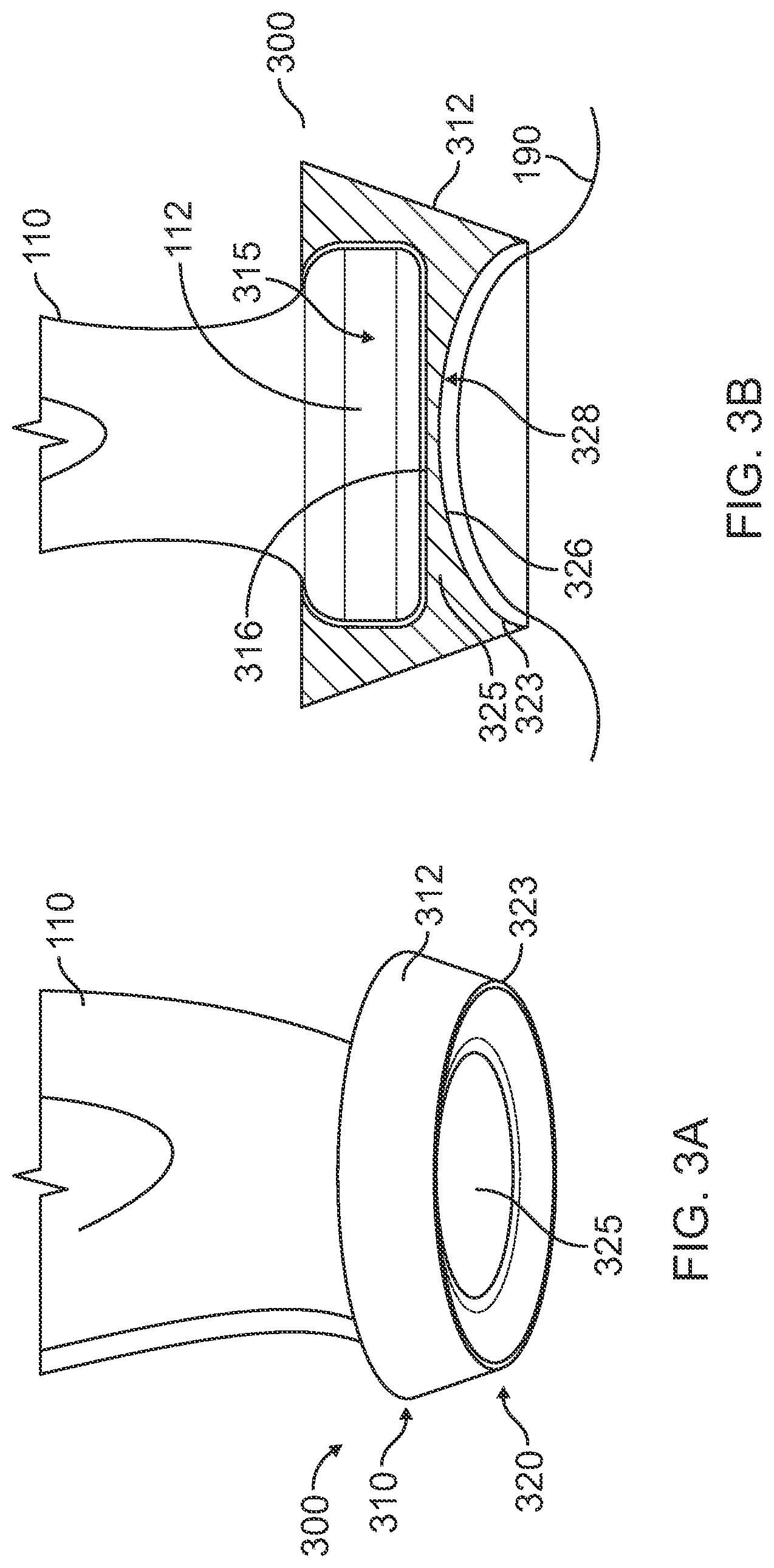 Patent US12324704 Figure 5 – Securement of hands-free ultrasound probe