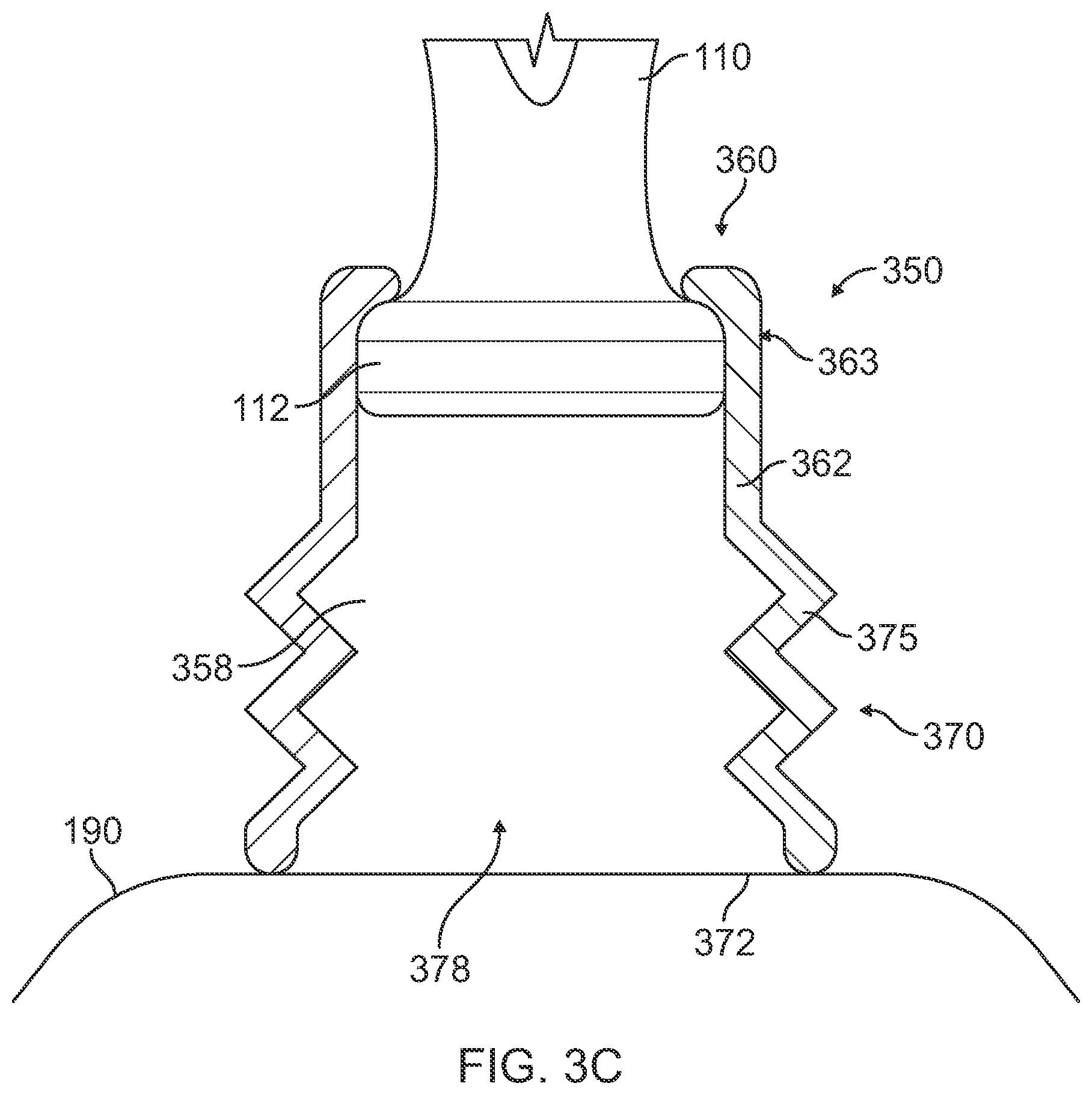 Patent US12324704 Figure 6 – Securement of hands-free ultrasound probe