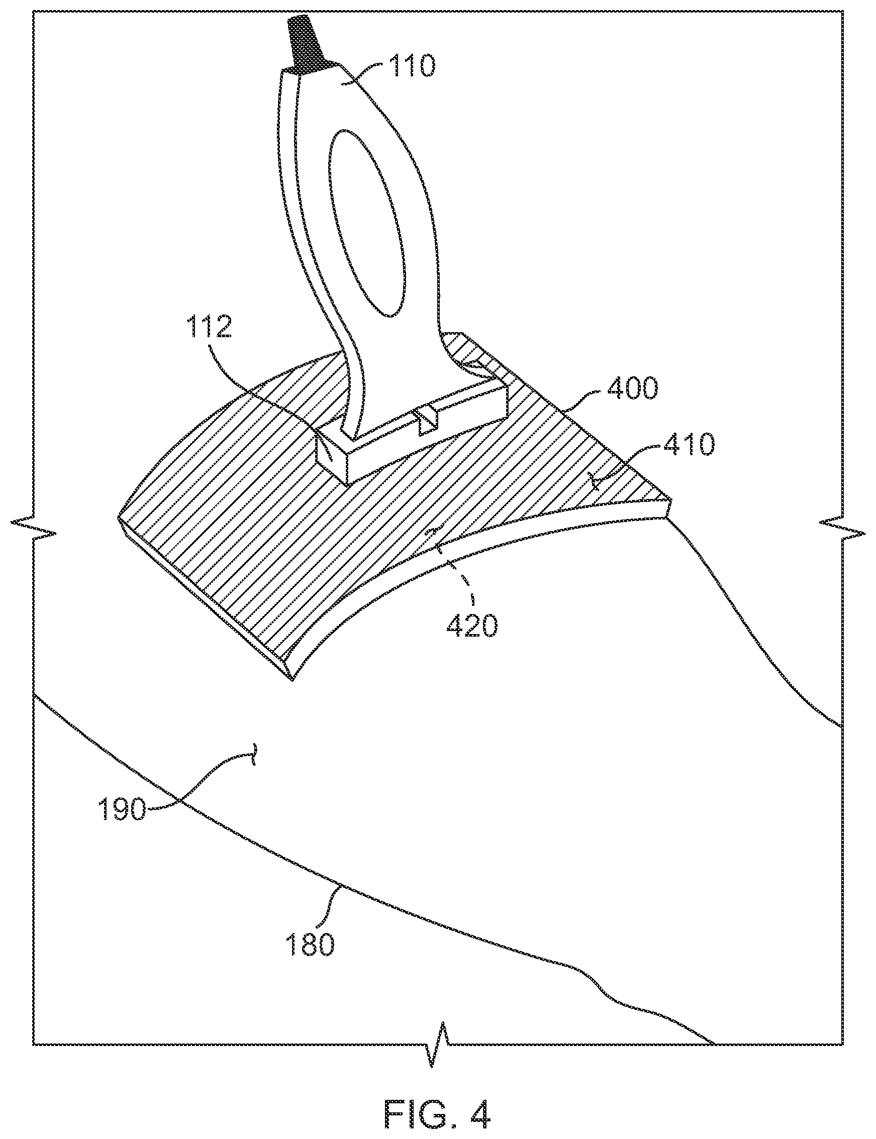 Patent US12324704 Figure 7 – Securement of hands-free ultrasound probe
