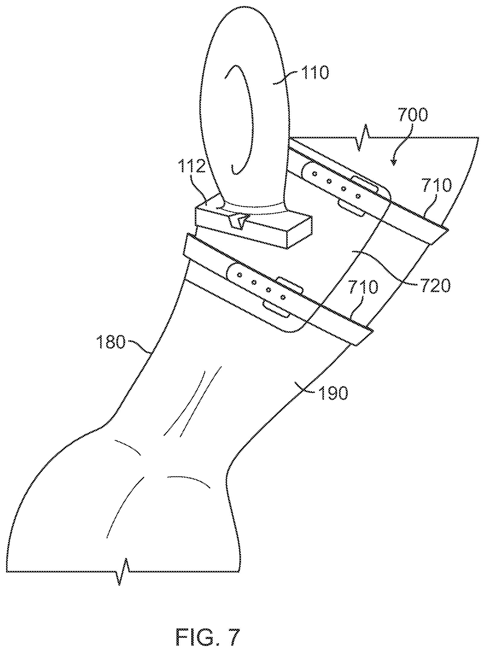 Patent US12324704 Figure 10 – Securement of hands-free ultrasound probe