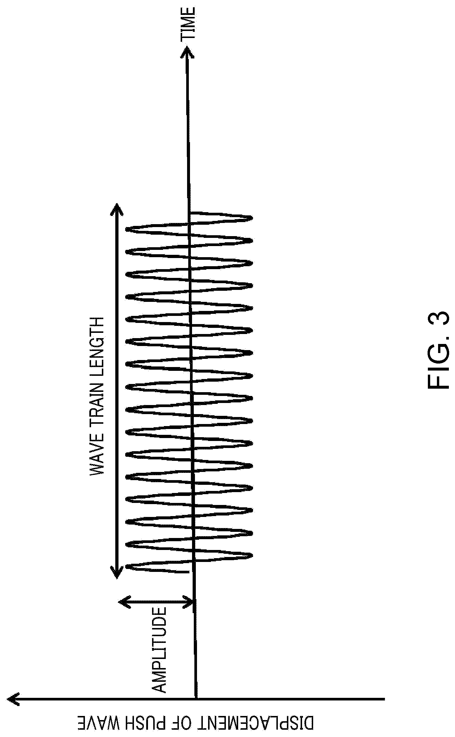 Patent US12324706 Figure 3 – Ultrasound diagnostic apparatus