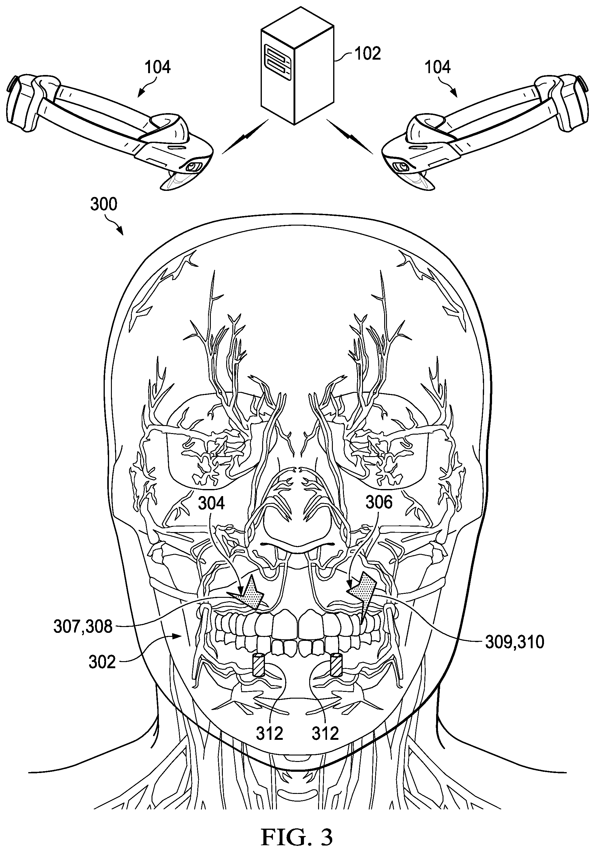 Patent US12324708 Figure 2 – Augmented reality dental surgery