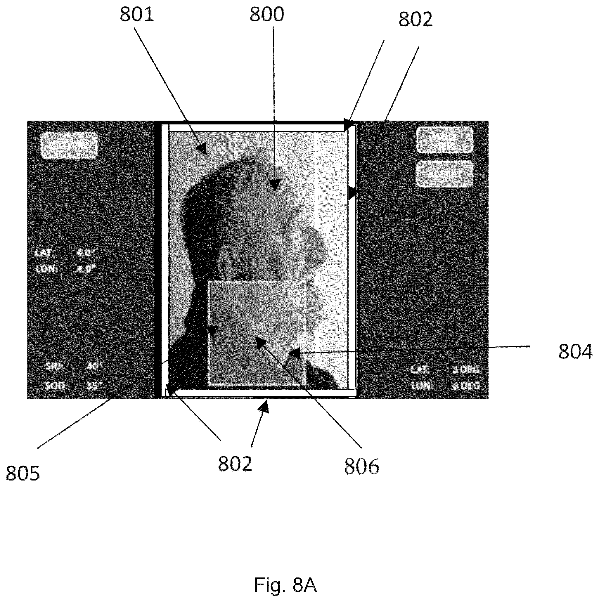 Patent US12324709 Figure 9 – System and method for controlling a collimator