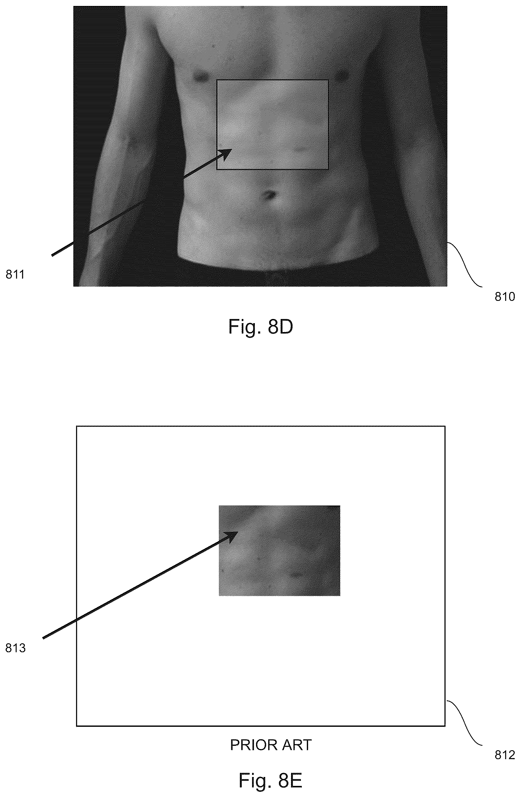 Patent US12324709 Figure 11 – System and method for controlling a collimator