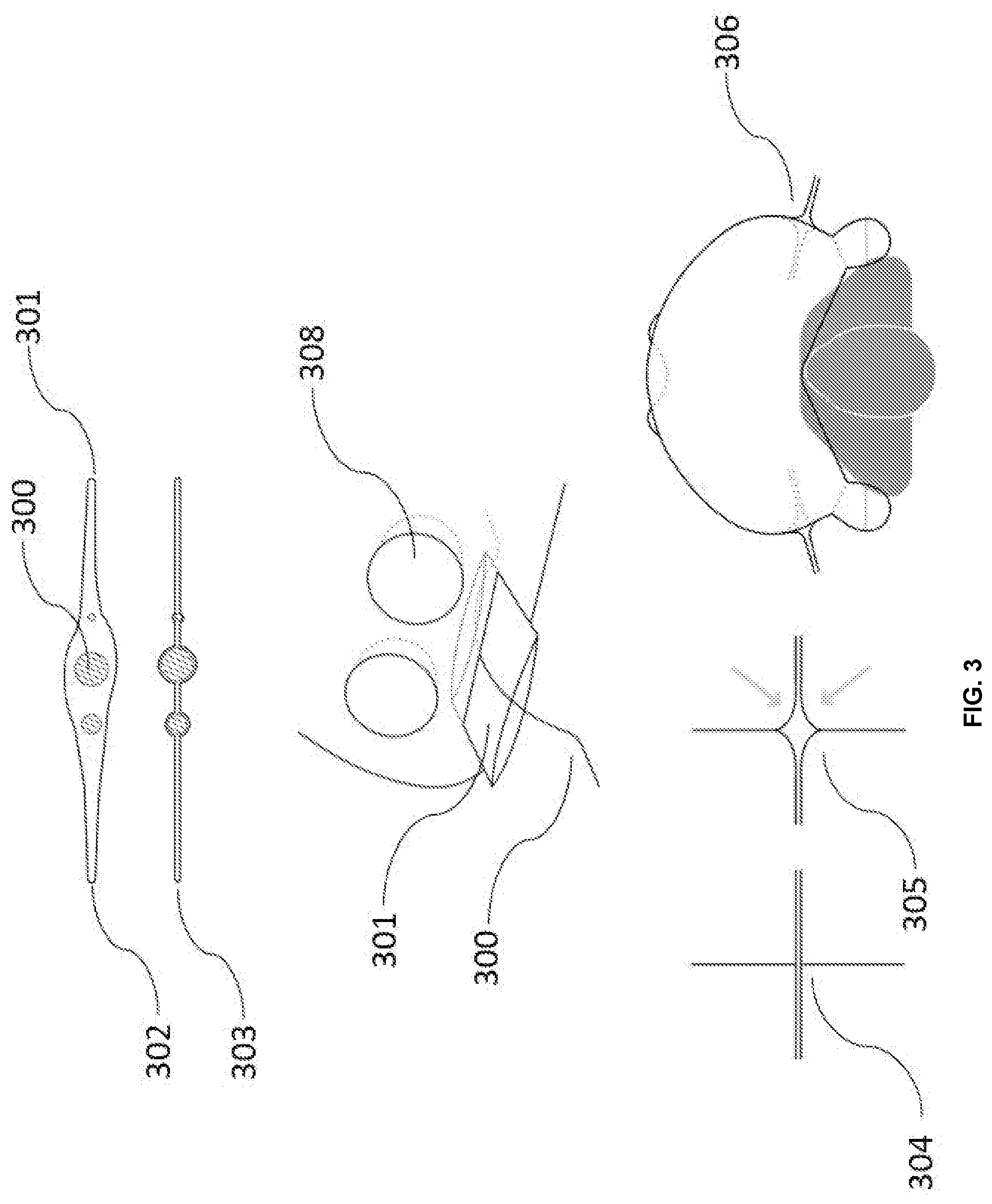 Patent US12324711 Figure 3 – Data analytics and interface platform for portable surgical enclosure