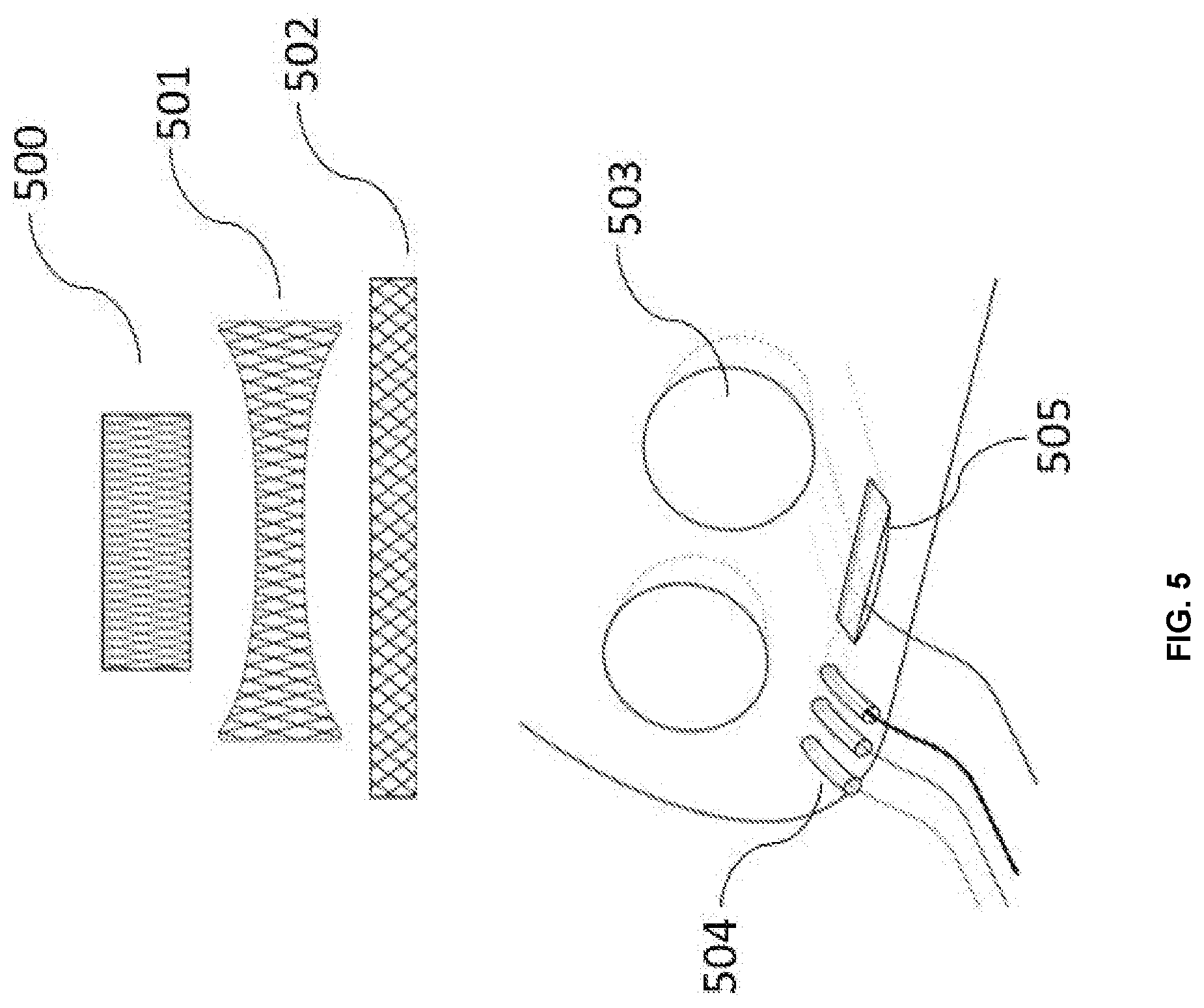 Patent US12324711 Figure 5 – Data analytics and interface platform for portable surgical enclosure
