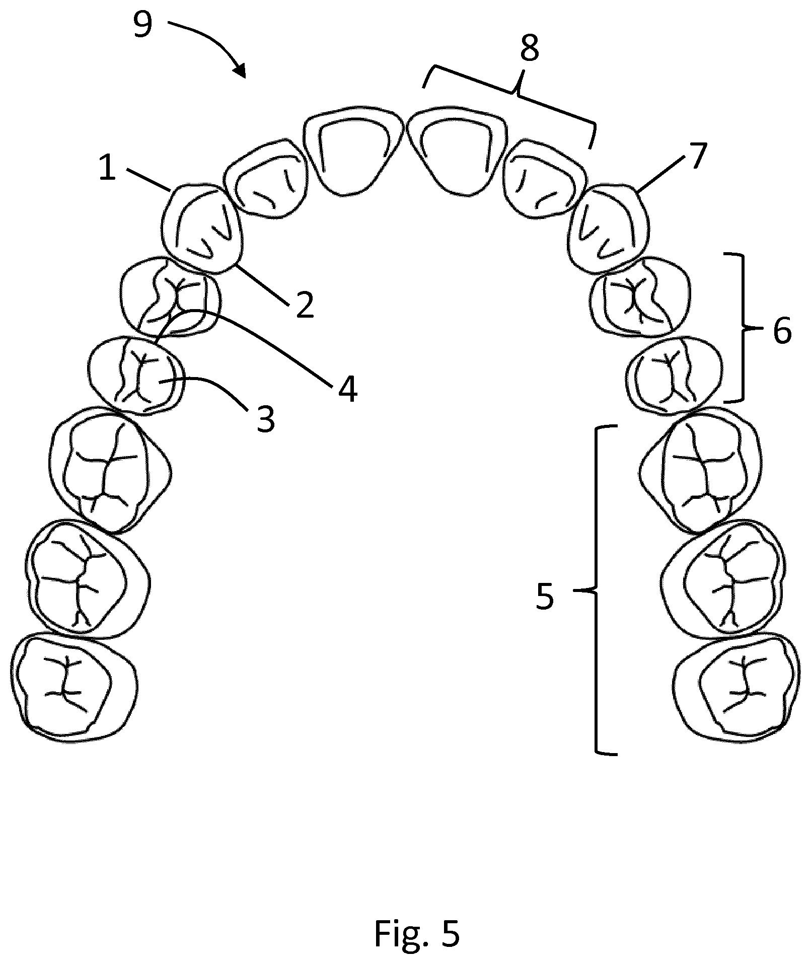 Patent US12324714 Figure 5 – Method for producing a dental restoration