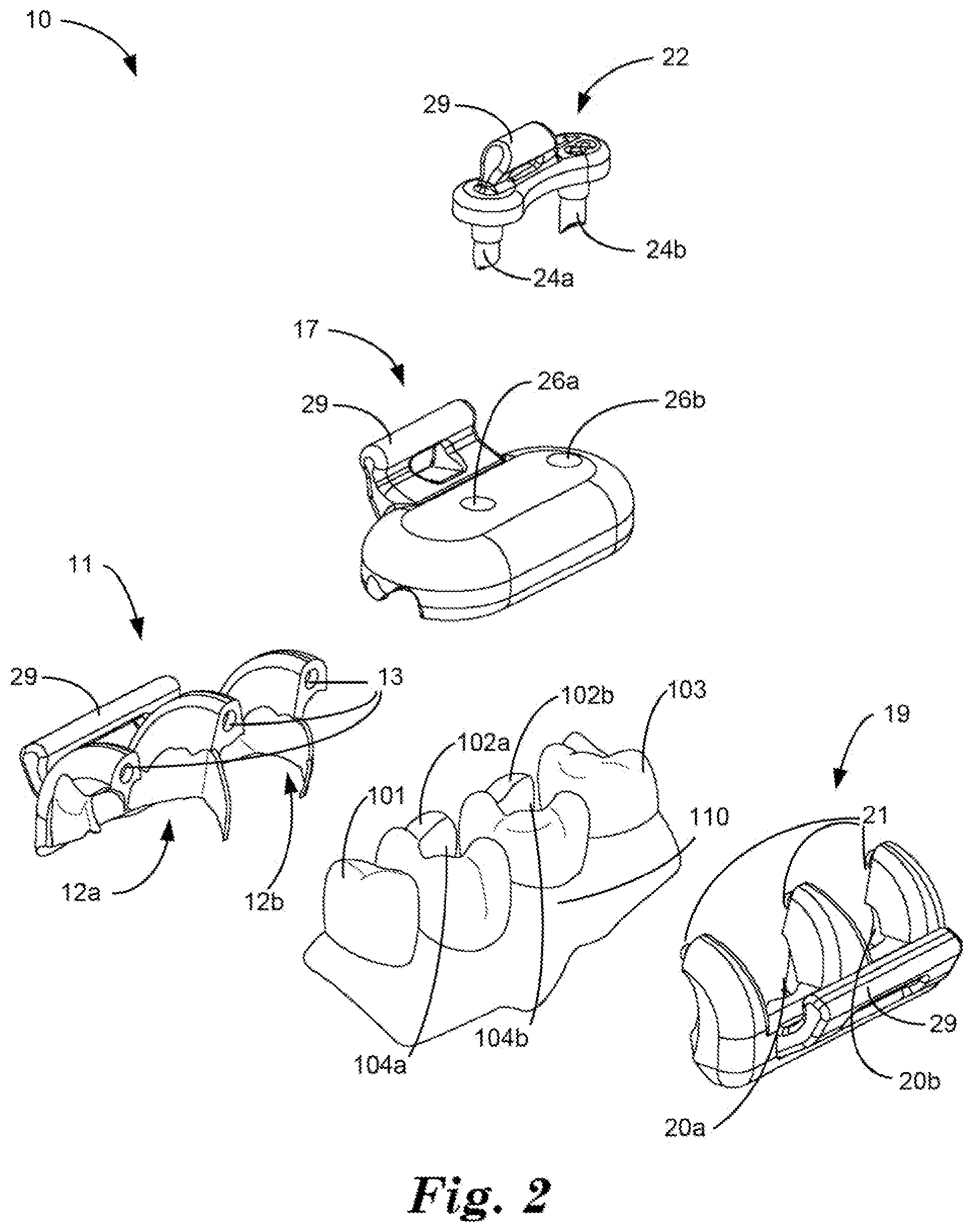 Patent US12324715 Figure 2 – Dental restoration molds