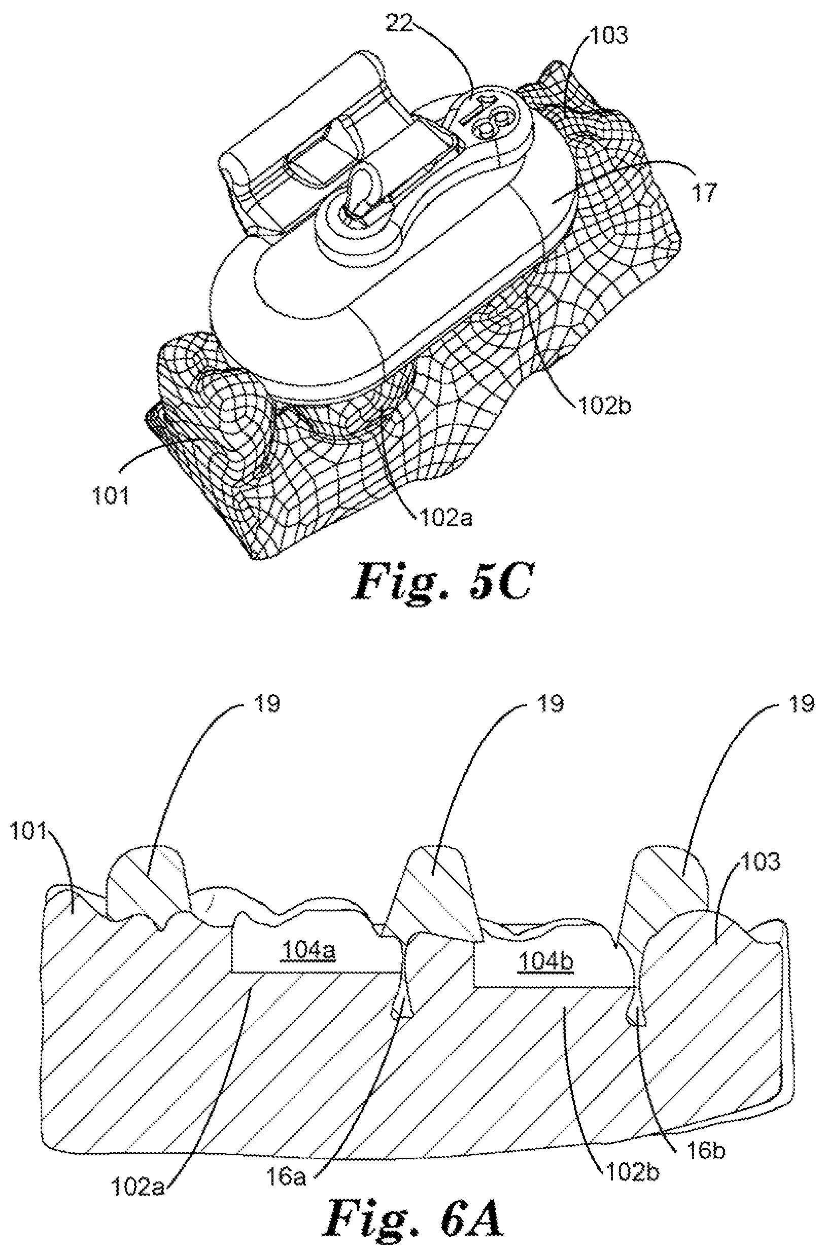 Patent US12324715 Figure 5 – Dental restoration molds