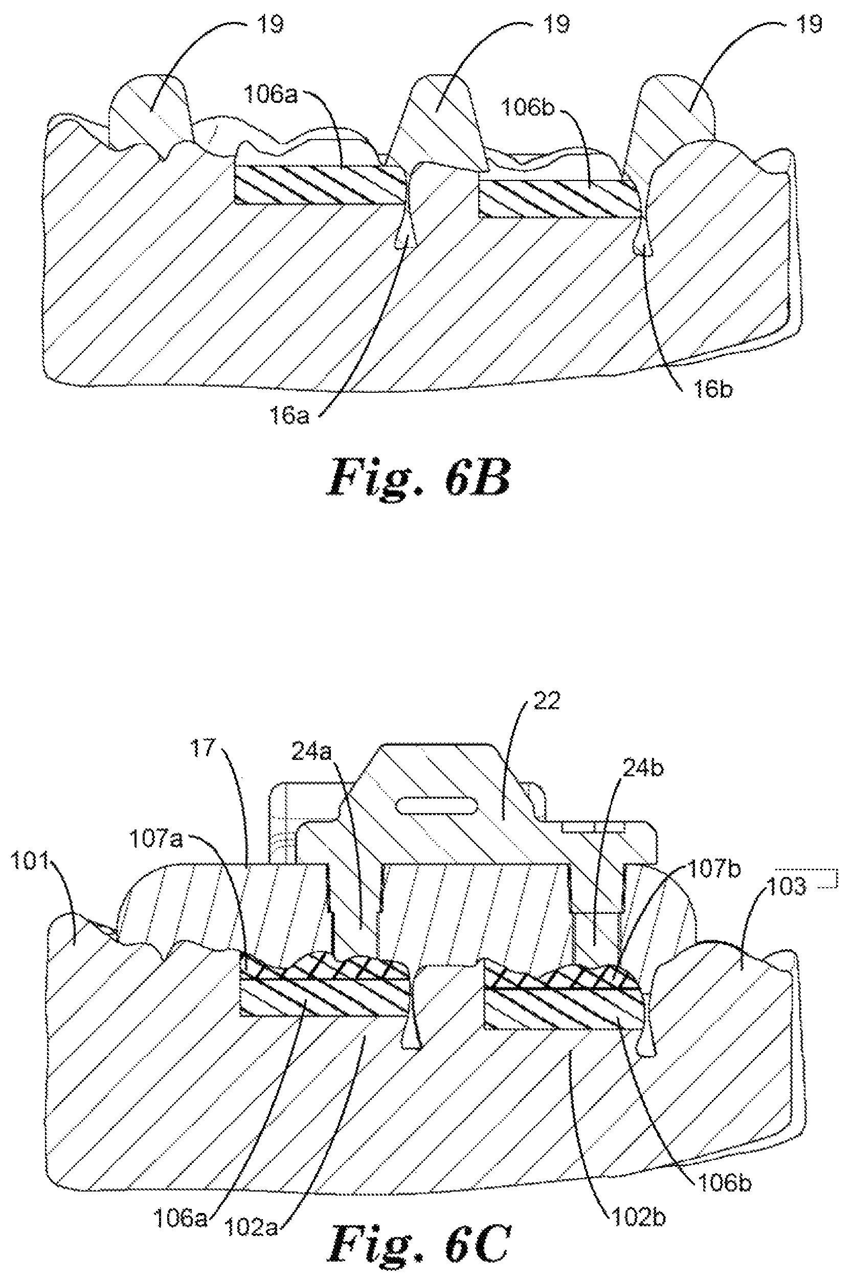 Patent US12324715 Figure 6 – Dental restoration molds