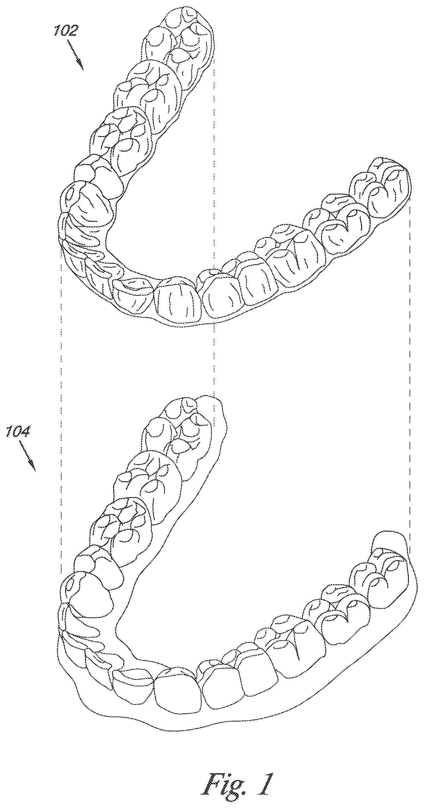 Patent US12324720 Figure 1 – Bite setting for dental treatment planning