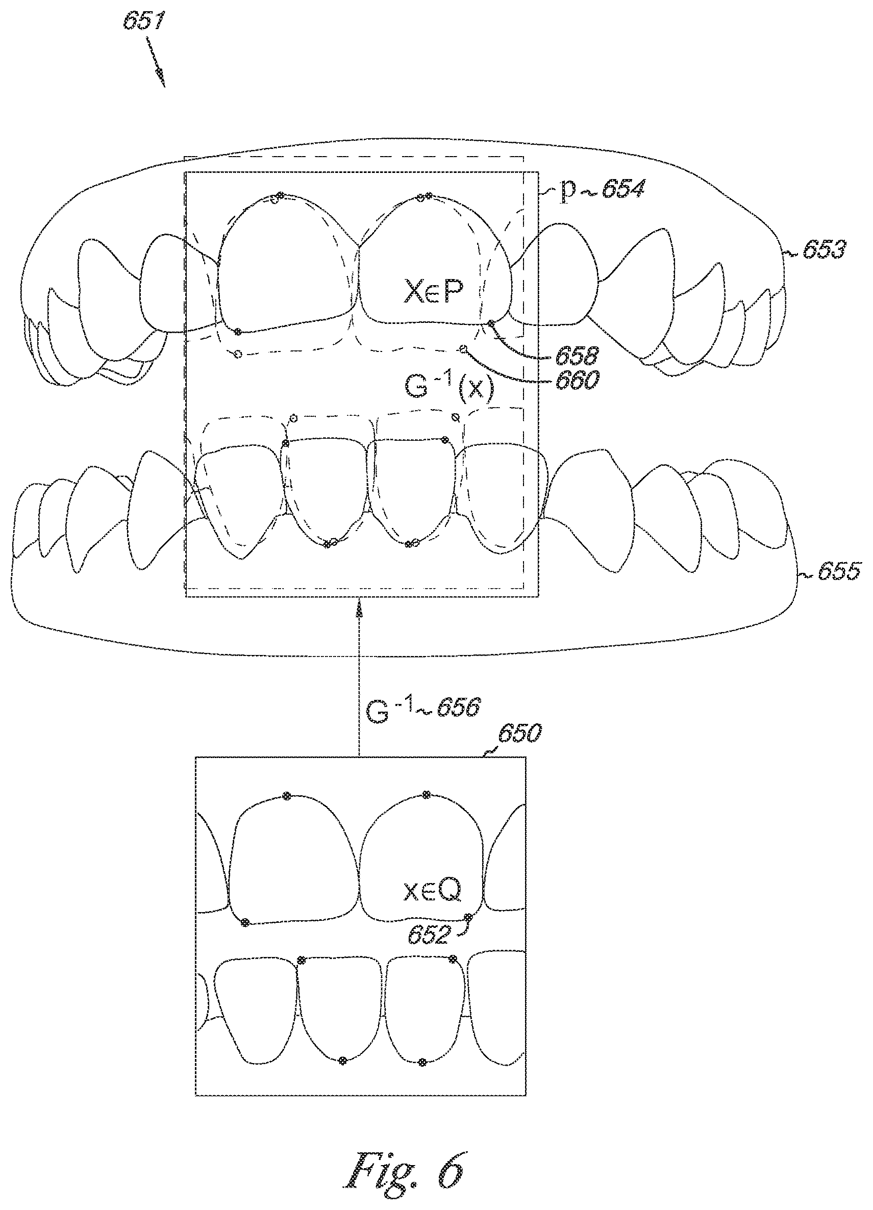 Patent US12324720 Figure 5 – Bite setting for dental treatment planning